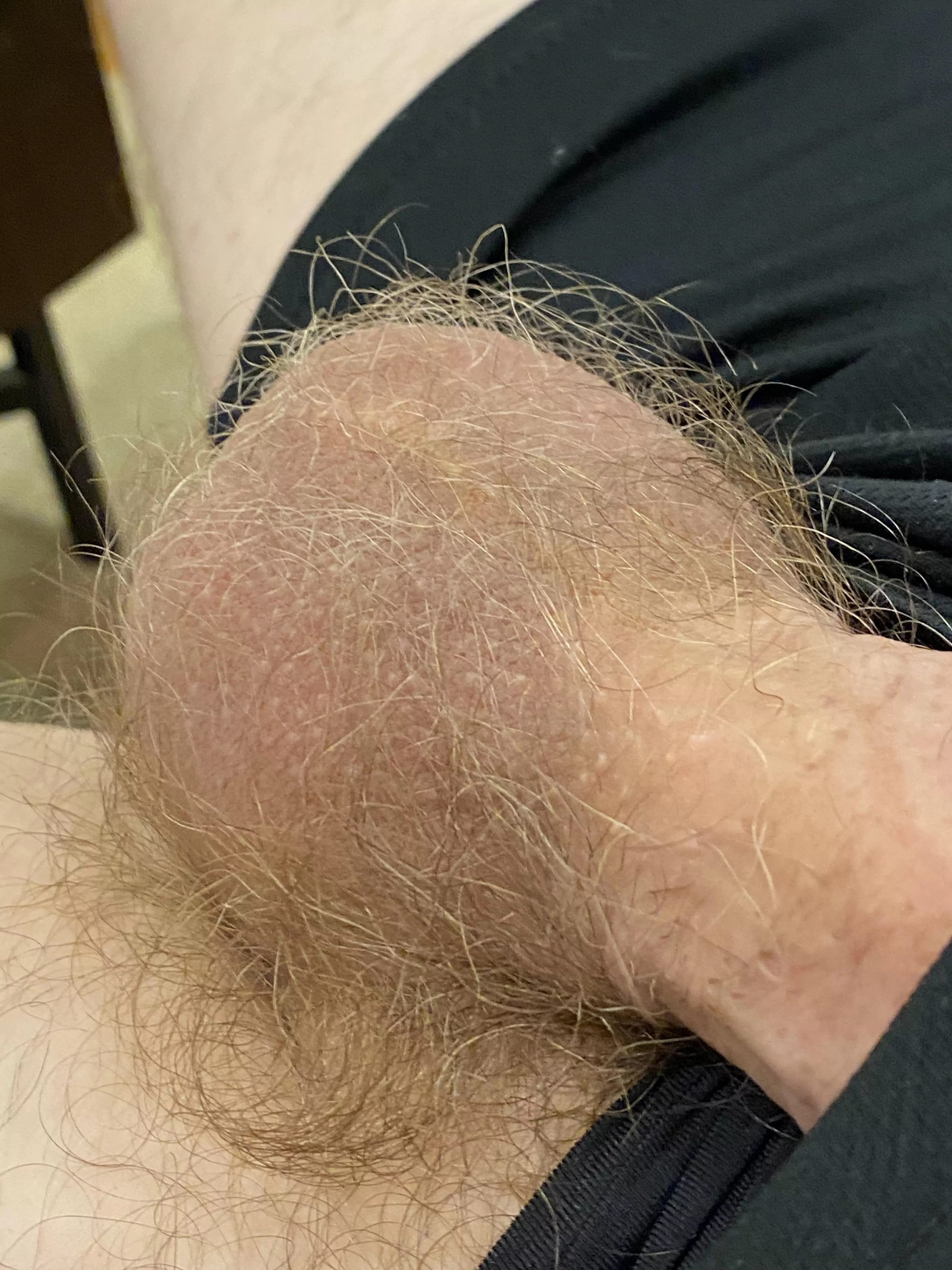 my nutsack is so fucking hairy bro