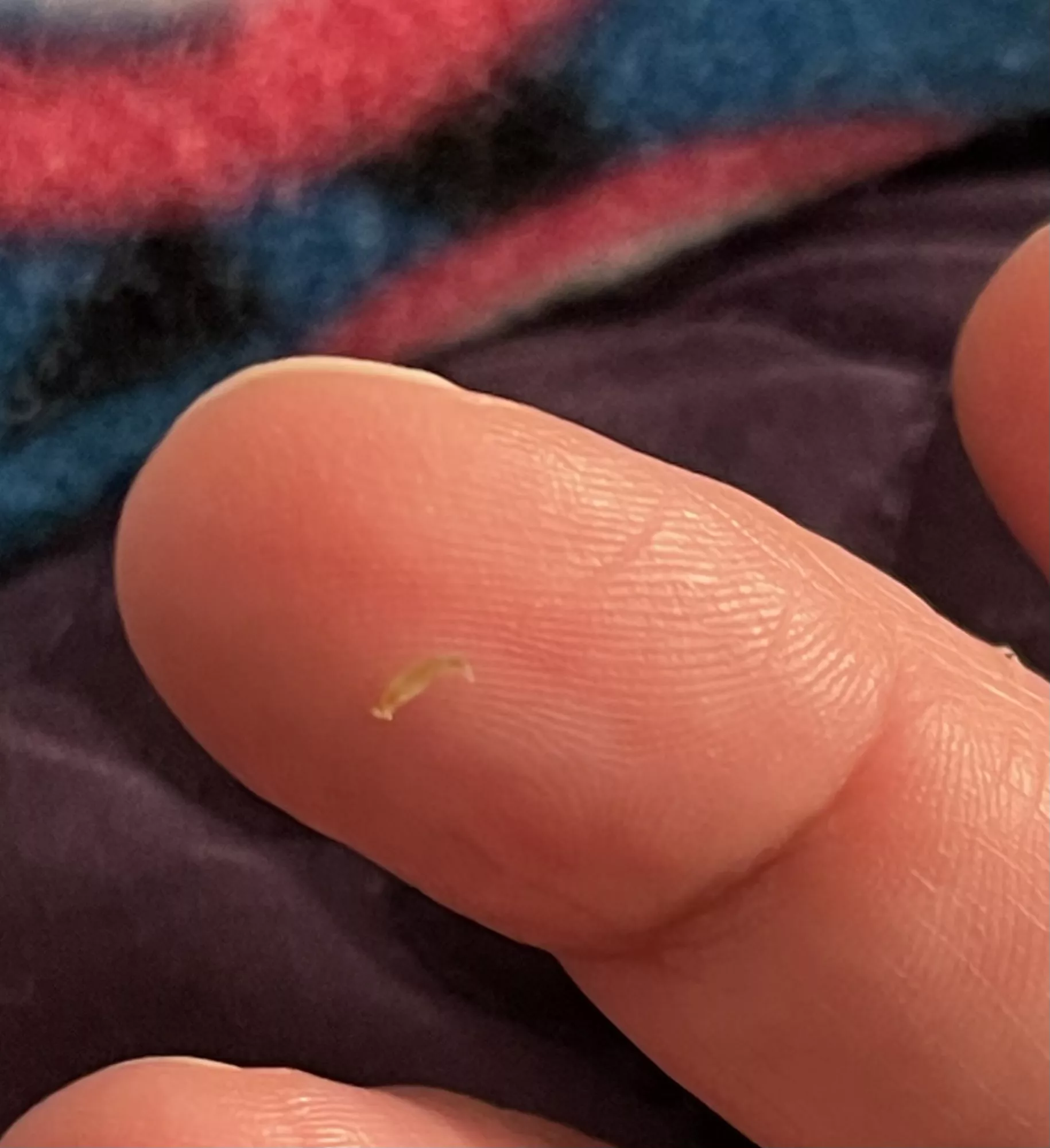 My son had a laparoscopic surgery when he was an infant. Every now and then, 10 years later, the tiny scar fills up and gets a black head. Got this cute little thing out of it just now! (No children were harmed during the squeezing)