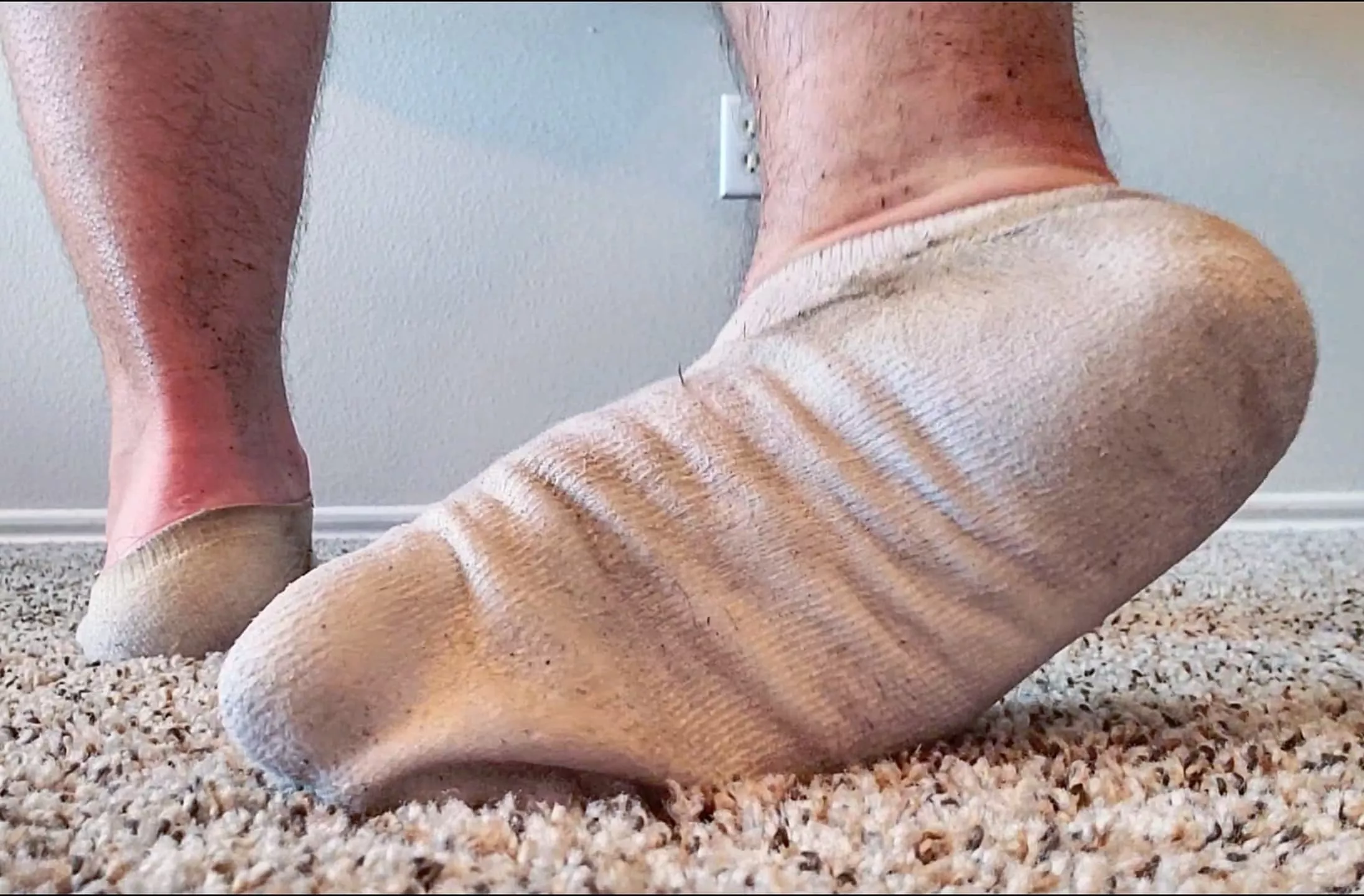 My sweat soaked 30+ day old socks after a run