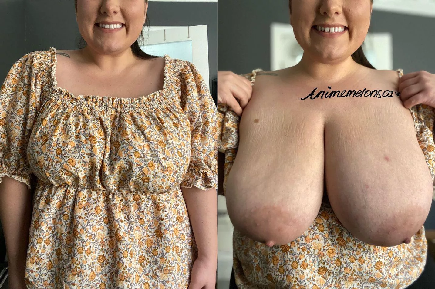 My tits: Before and after [OC]