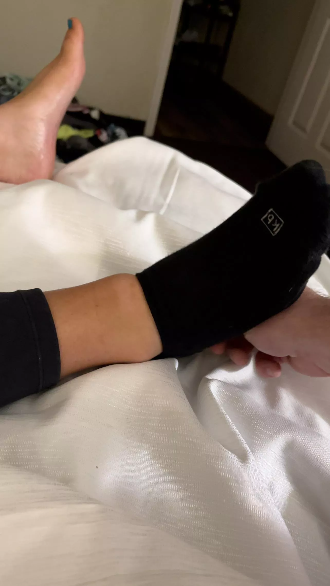 My wife’s swollen ankle after twisting it in tennis shoes and cute smelly ankle socks