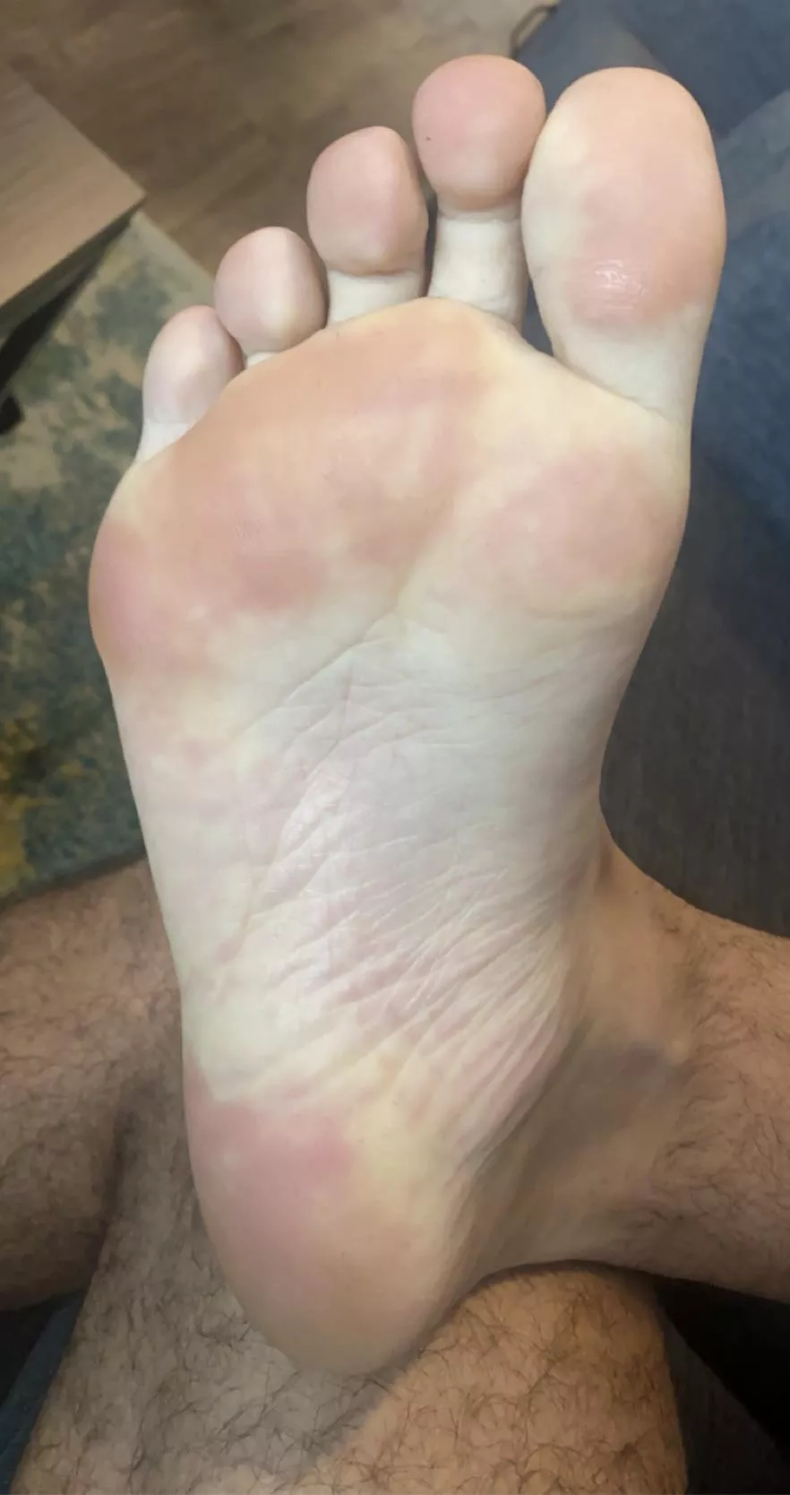 Nice and sweaty. Nothing like the look of my smooth soles after removing my stinky socks