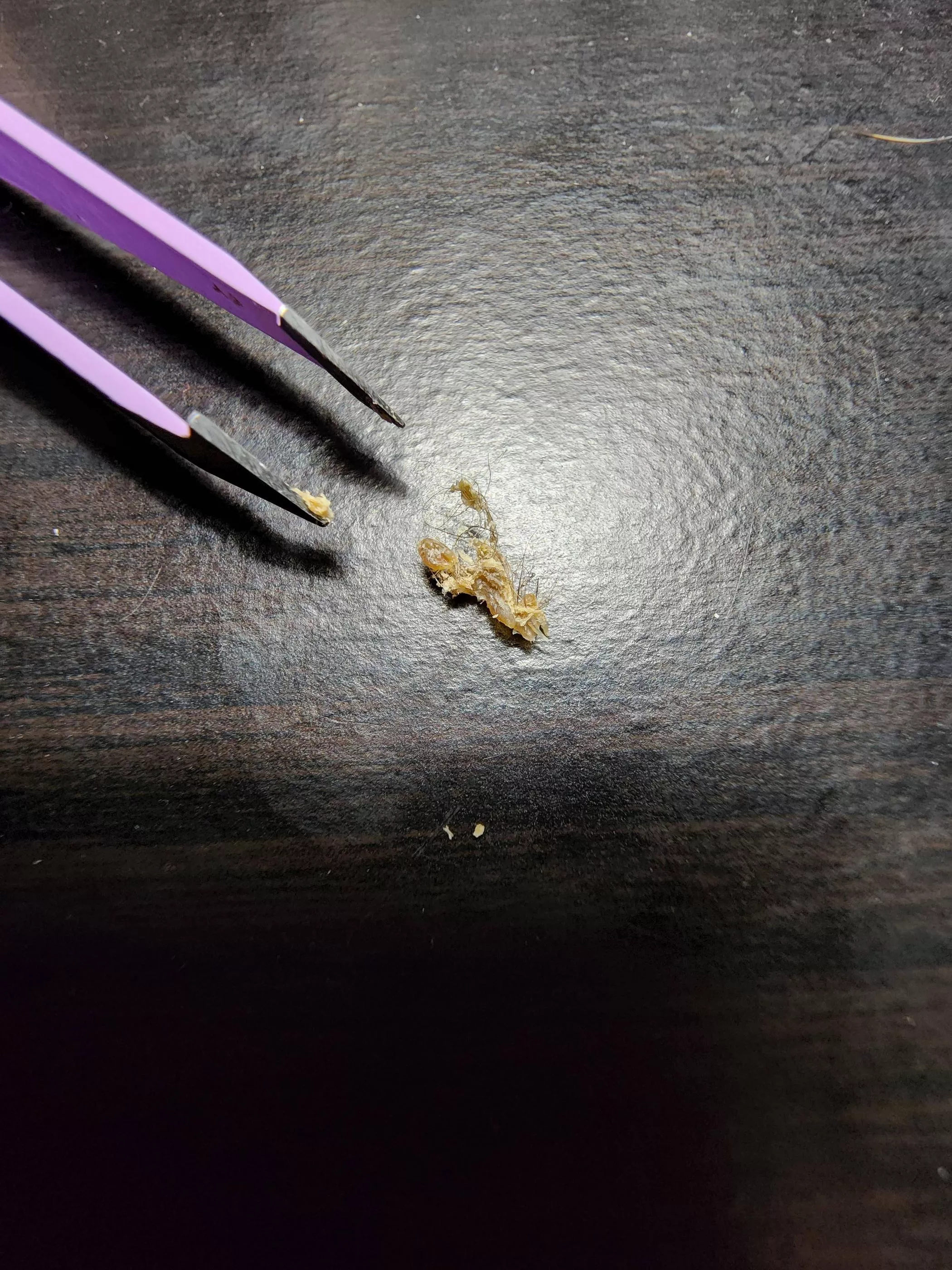 Not sure if this fits in this subreddit, but my wife just pulled this monstrosity out of my belly button