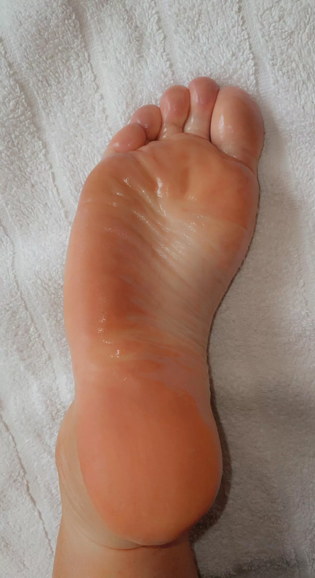 Oily soles