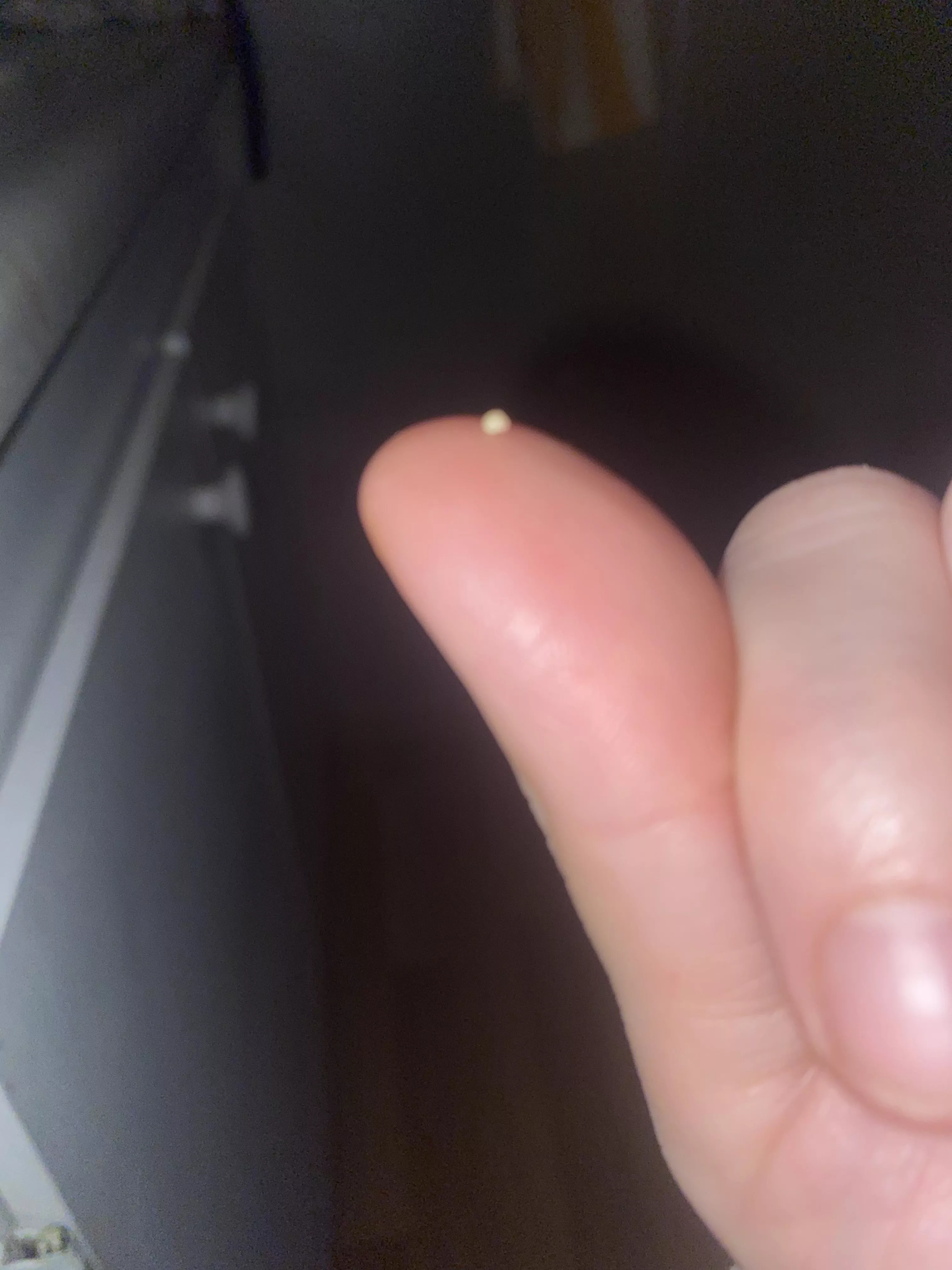 Popped a pimple this morning and this came out! It’s white, round and hard. My pimple feels so much better now.