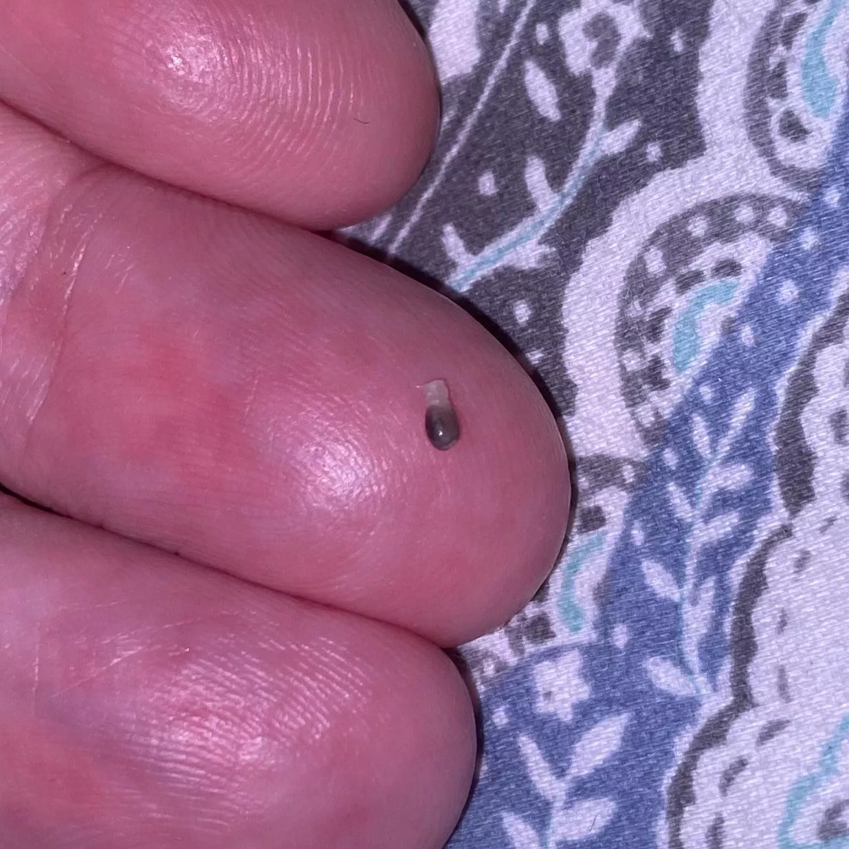 Popped this weird pellet out of an angry pimple on the back of my thigh