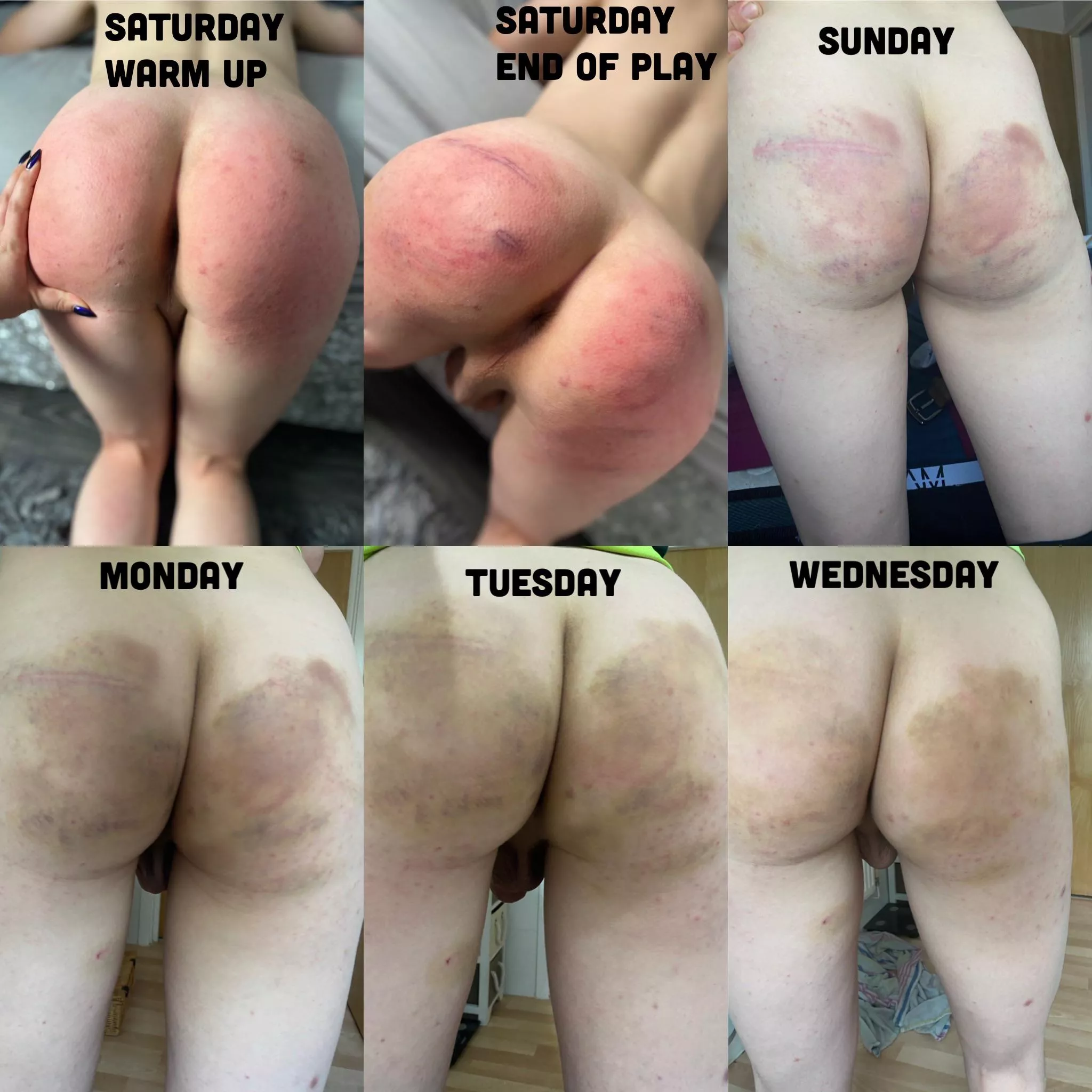 Progression of bruising from an amazing impact session with my Dutchess. A very tender but incredibly happy puppy 🖤😈