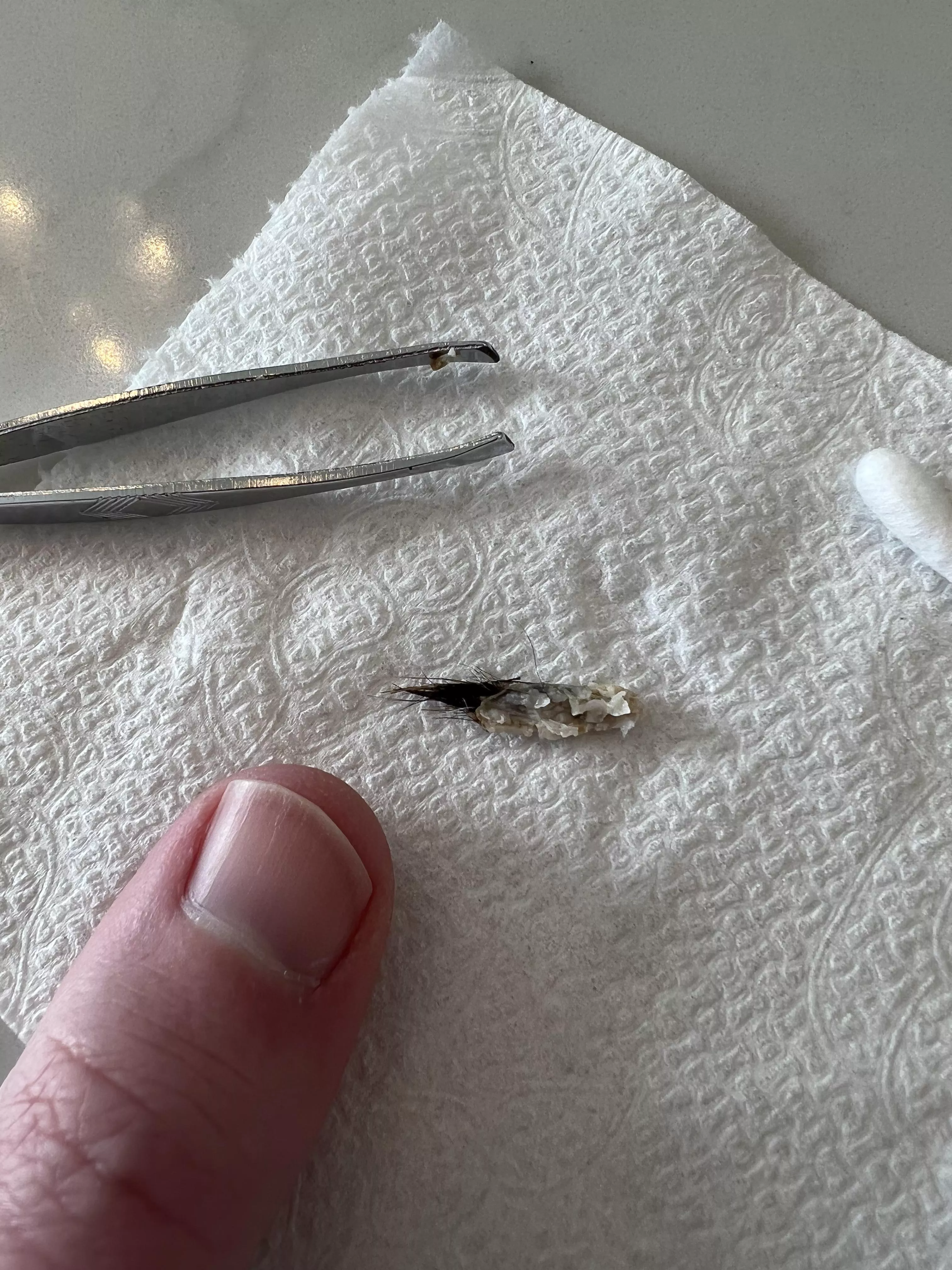 Pulled this out of my belly button this morning