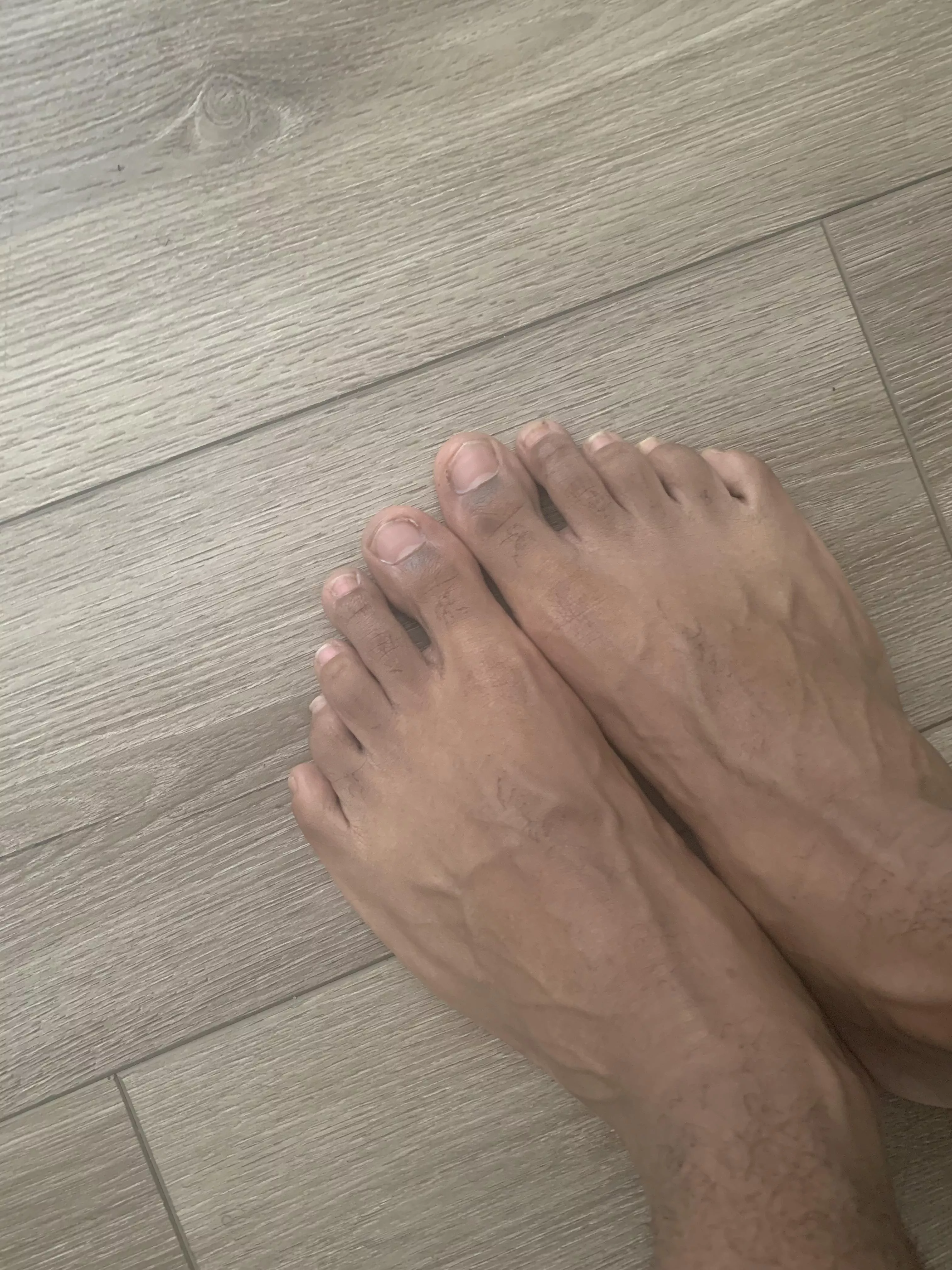 Rate my feet 🦶🏾 1-10??