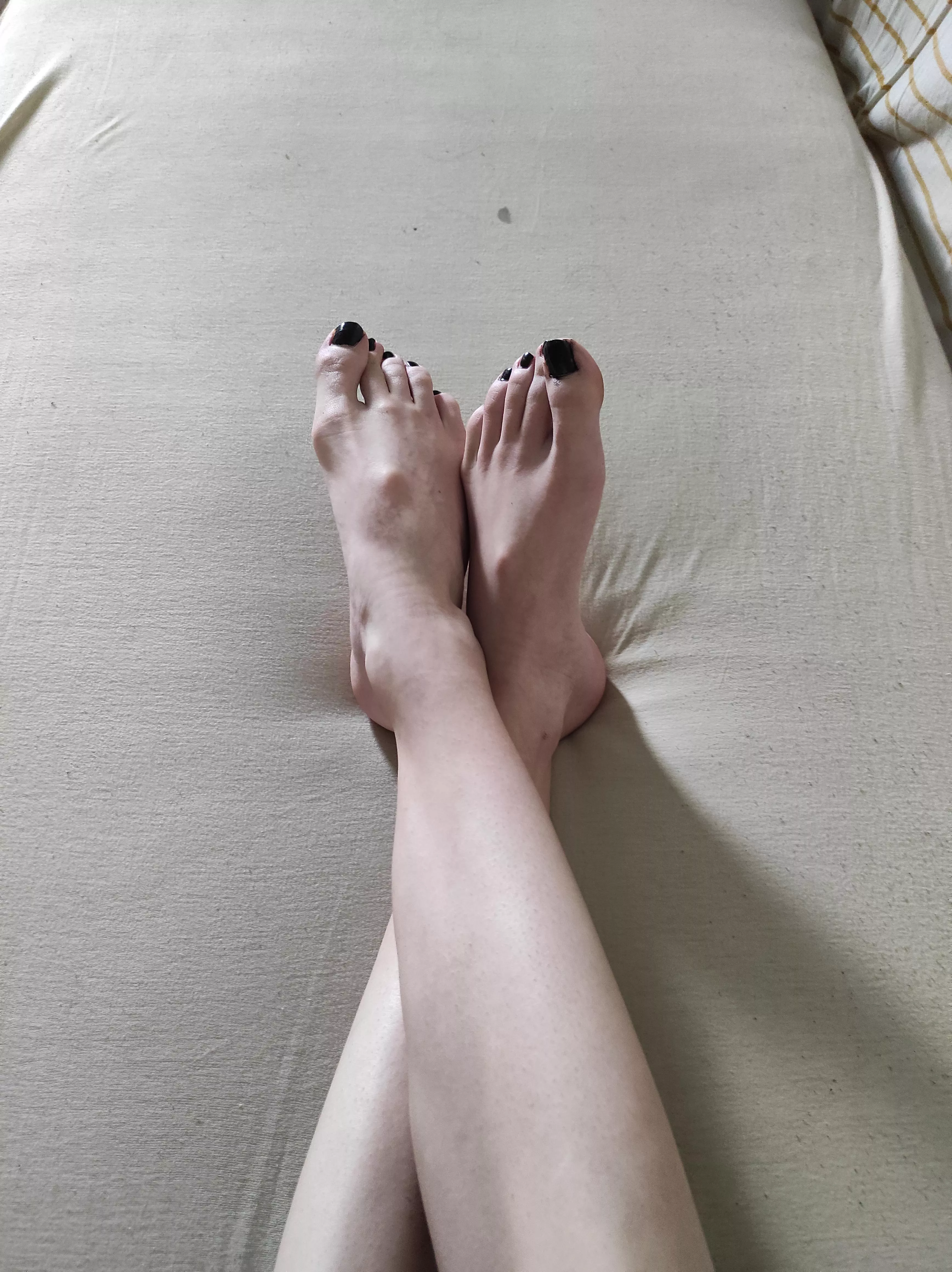 Rate my feet (be honest)