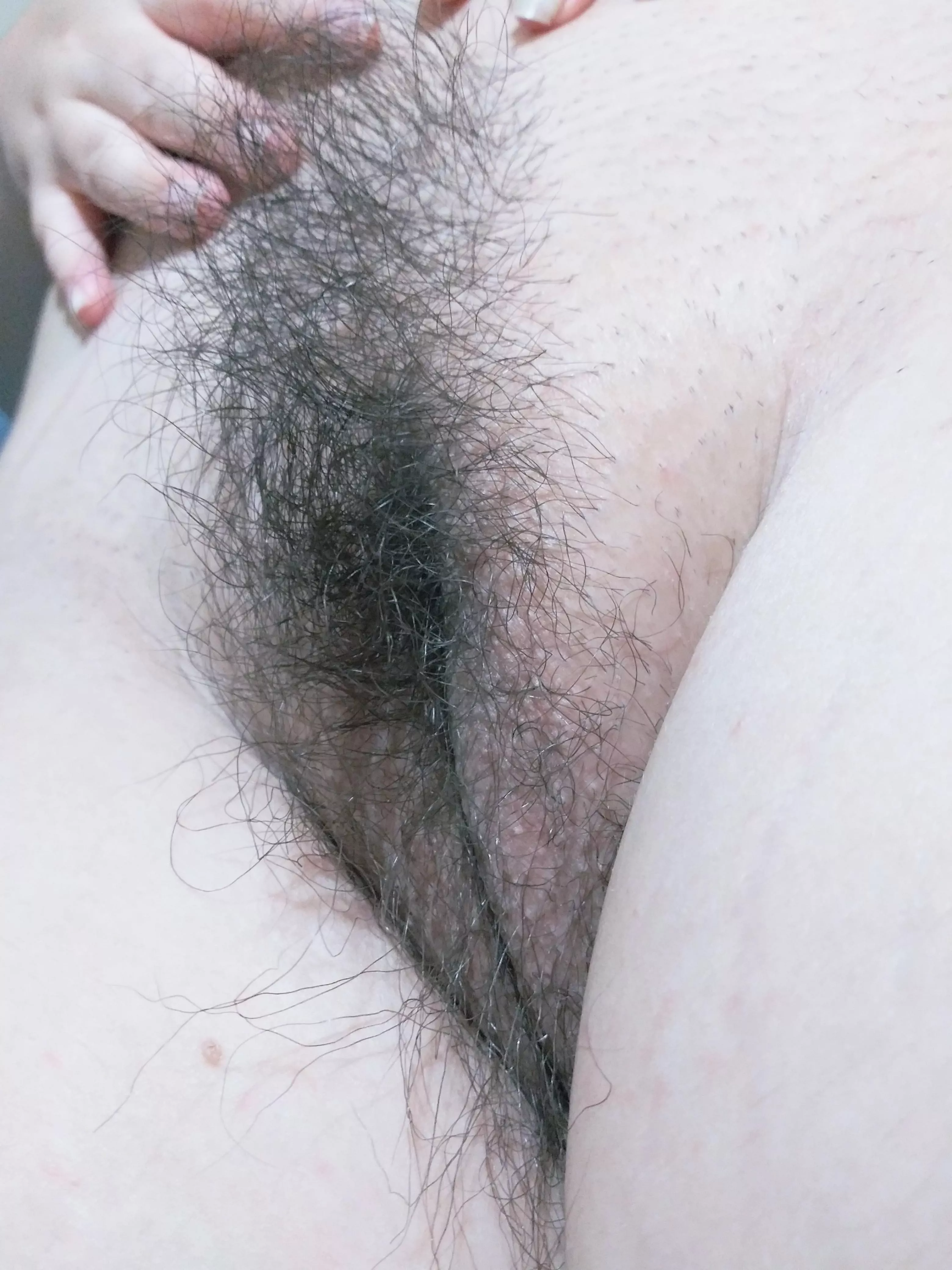 Rate my hairy? 🐱