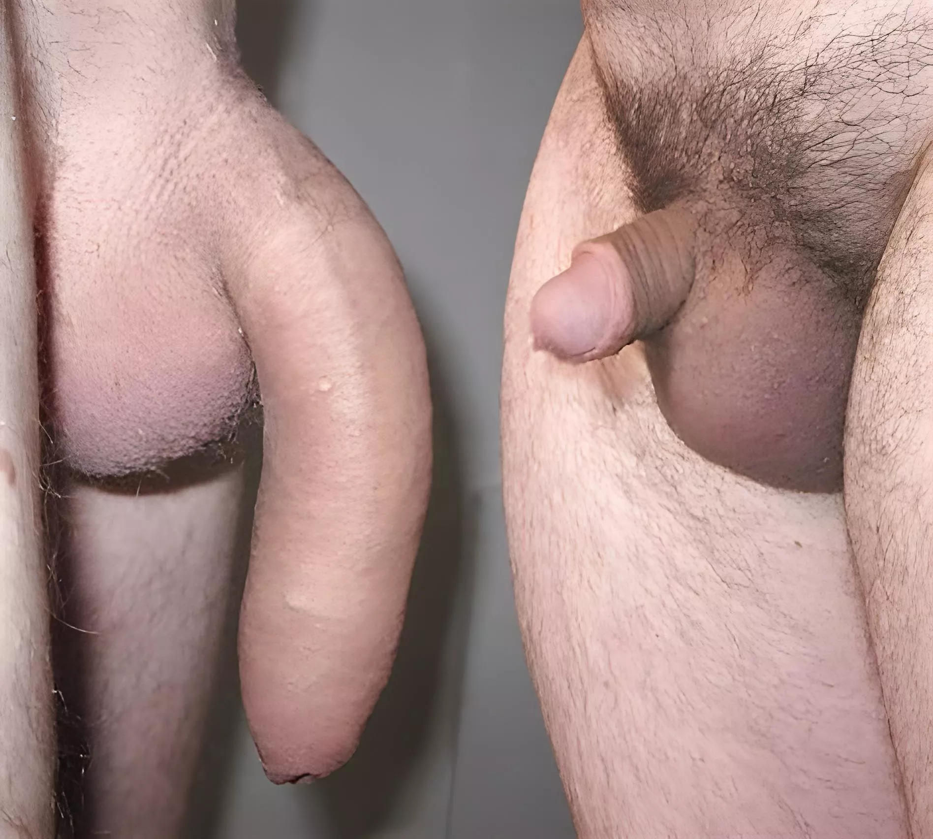 Small hard vs hung softie