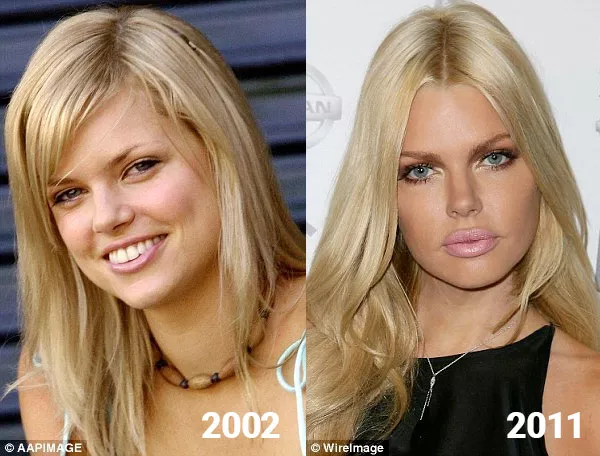 Sophie Monk, 9 years apart