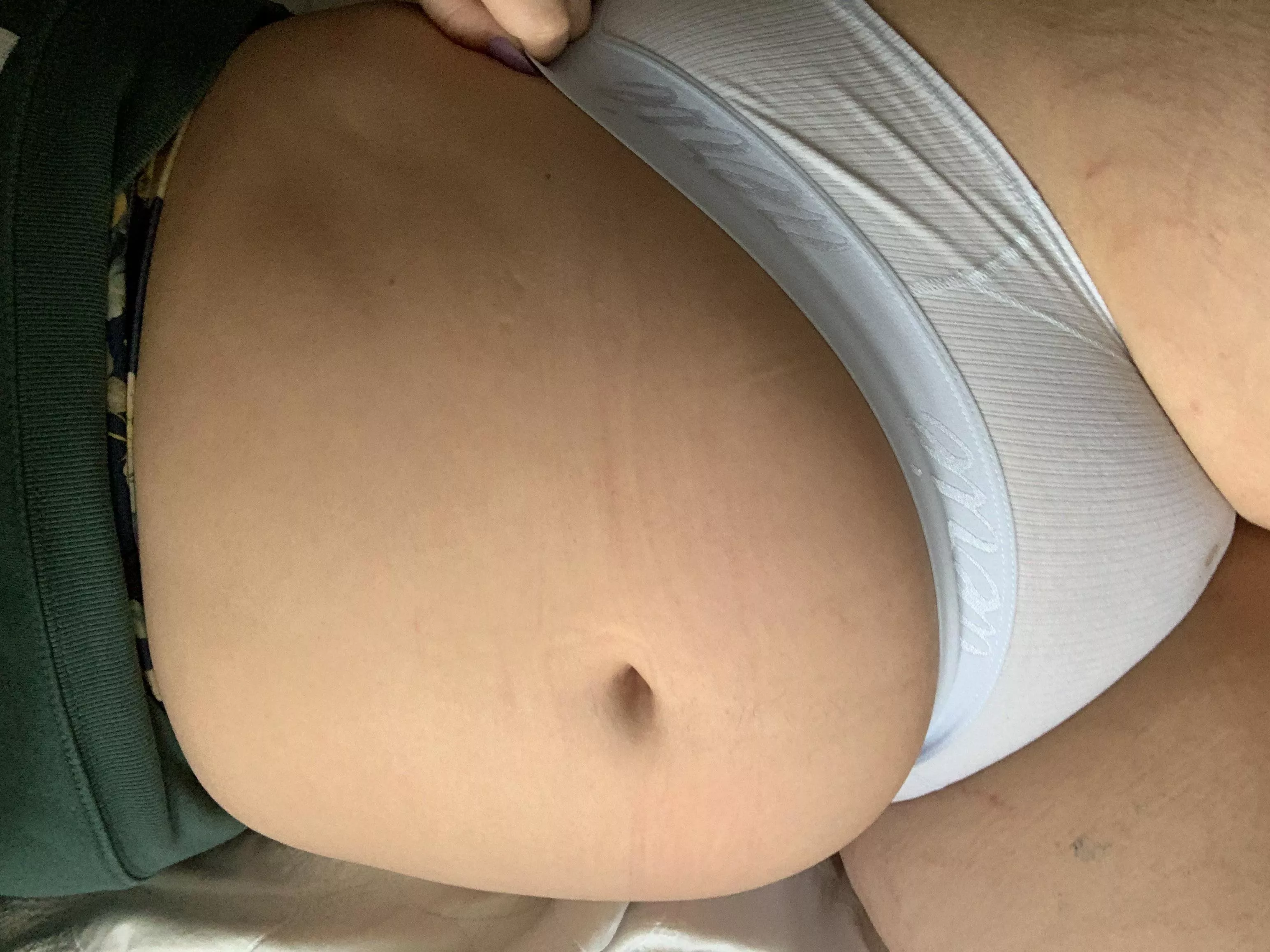 spring time and stretch marks!