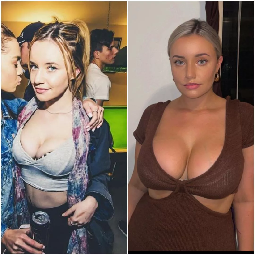 taylor's breast growth. six years of difference