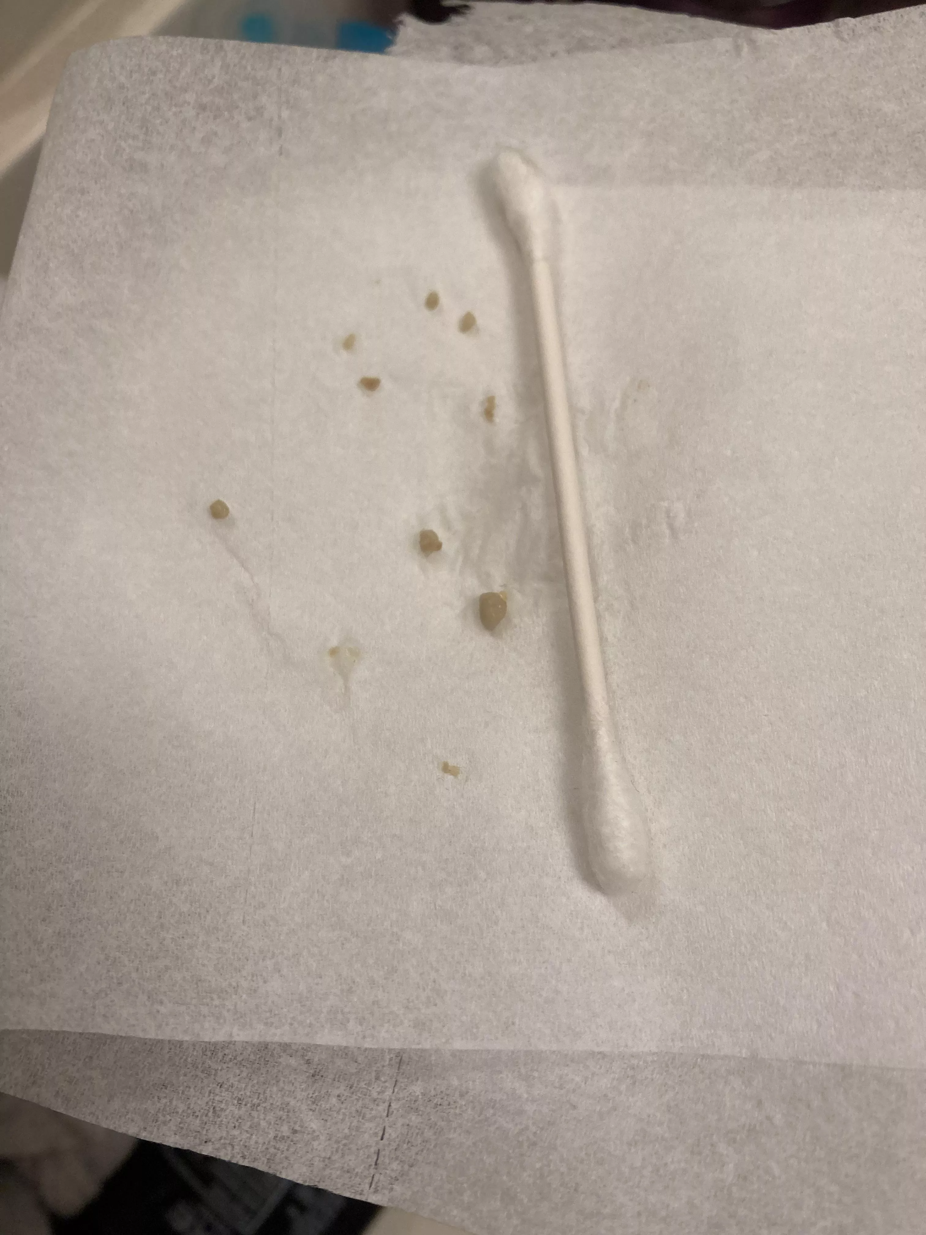 These guys popped out after I brushed my teeth… ugh q-tip for scale