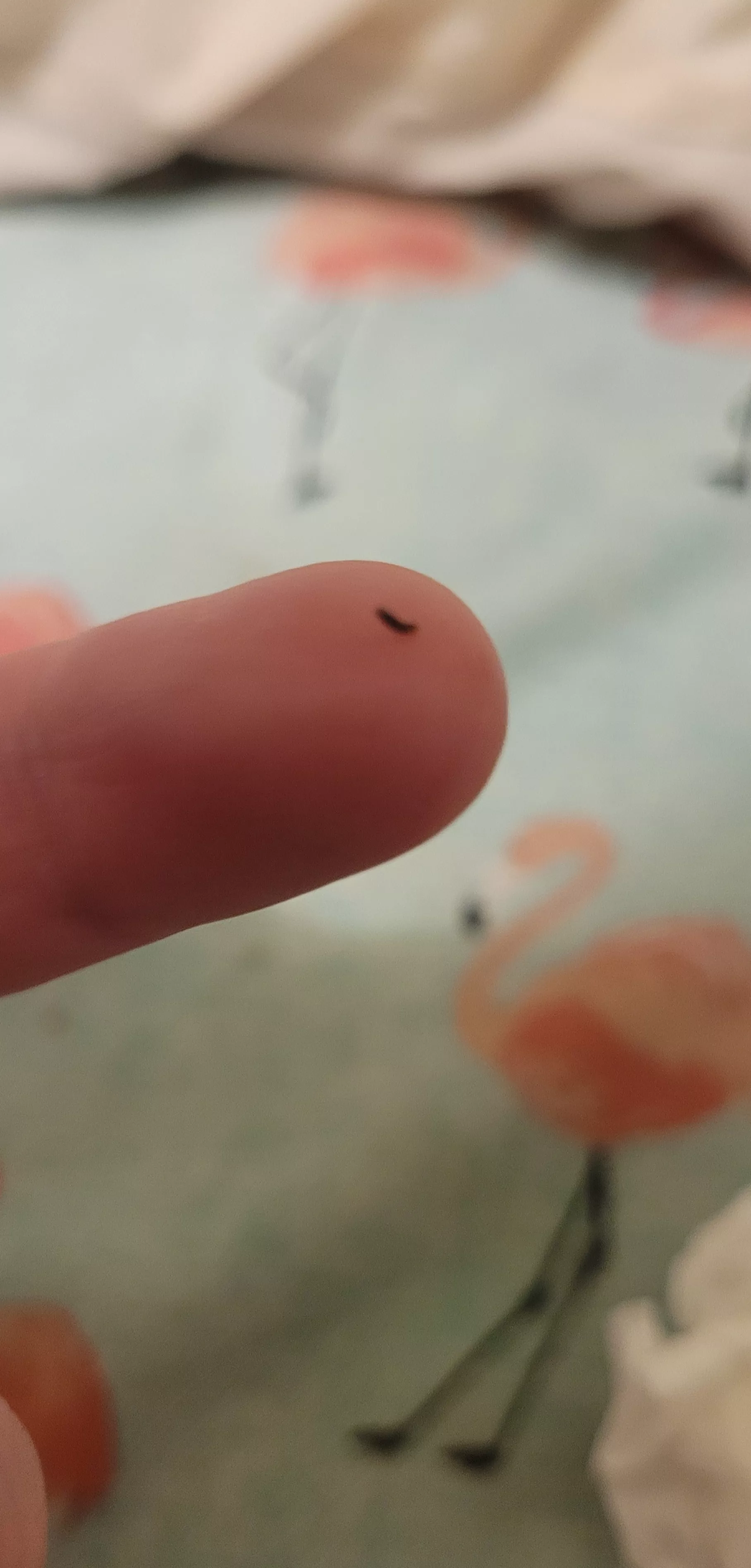 This blackhead just came out of my coochie (OC)