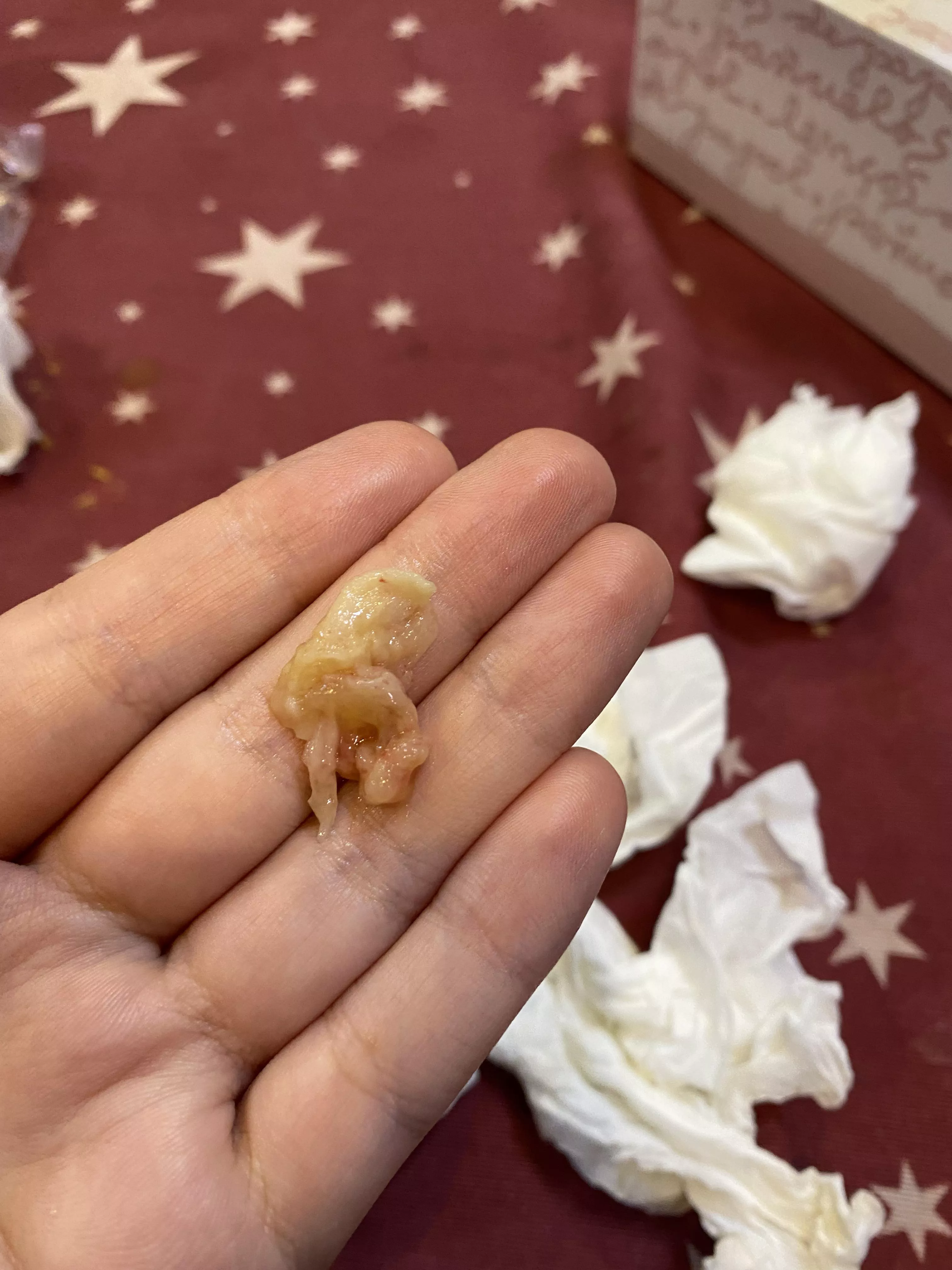 This coming out of my throat and I donâ€™t know what it is, is like chicken flesh