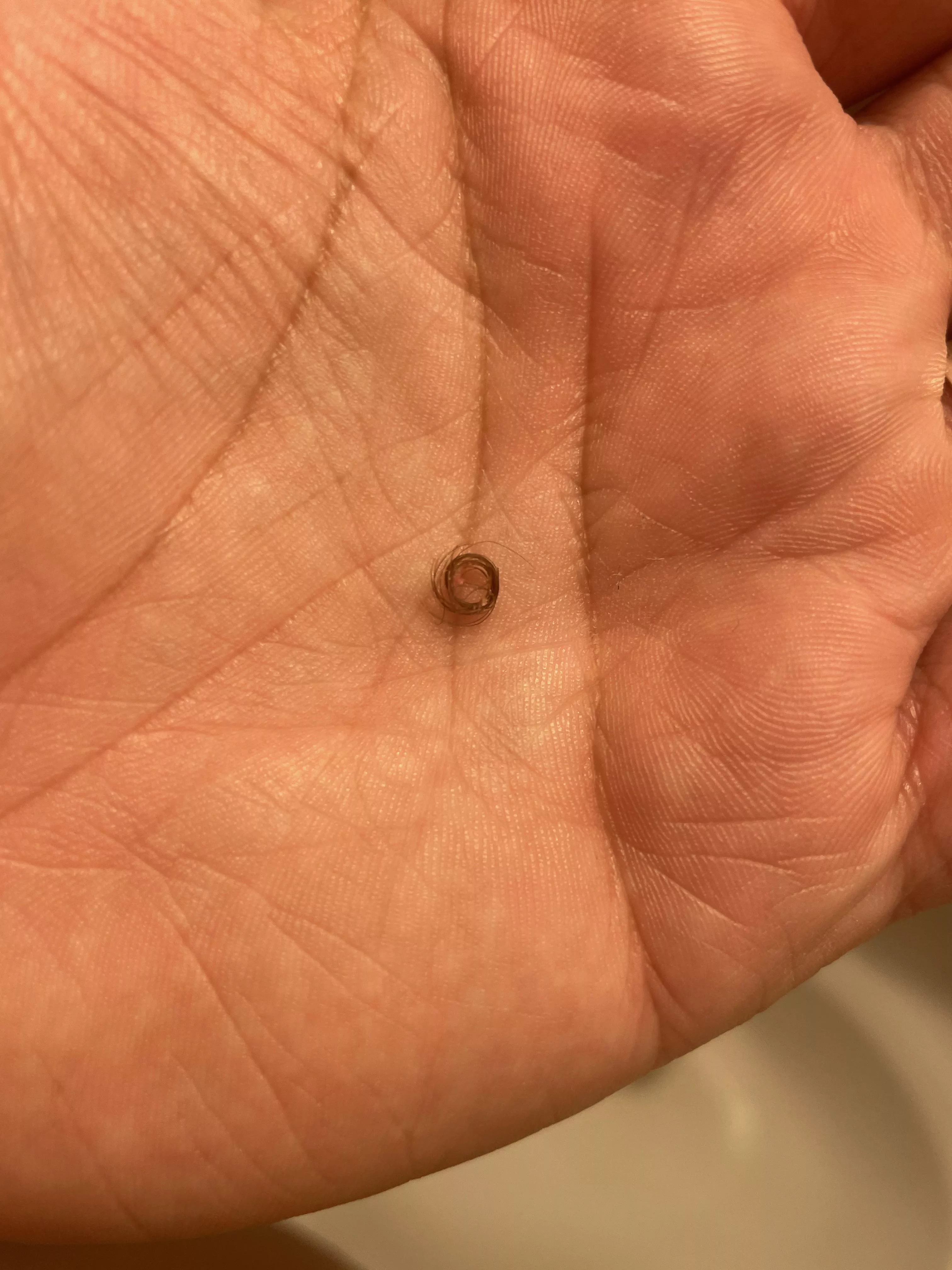 This pimple wouldn’t go away so I finally poked it and this popped out