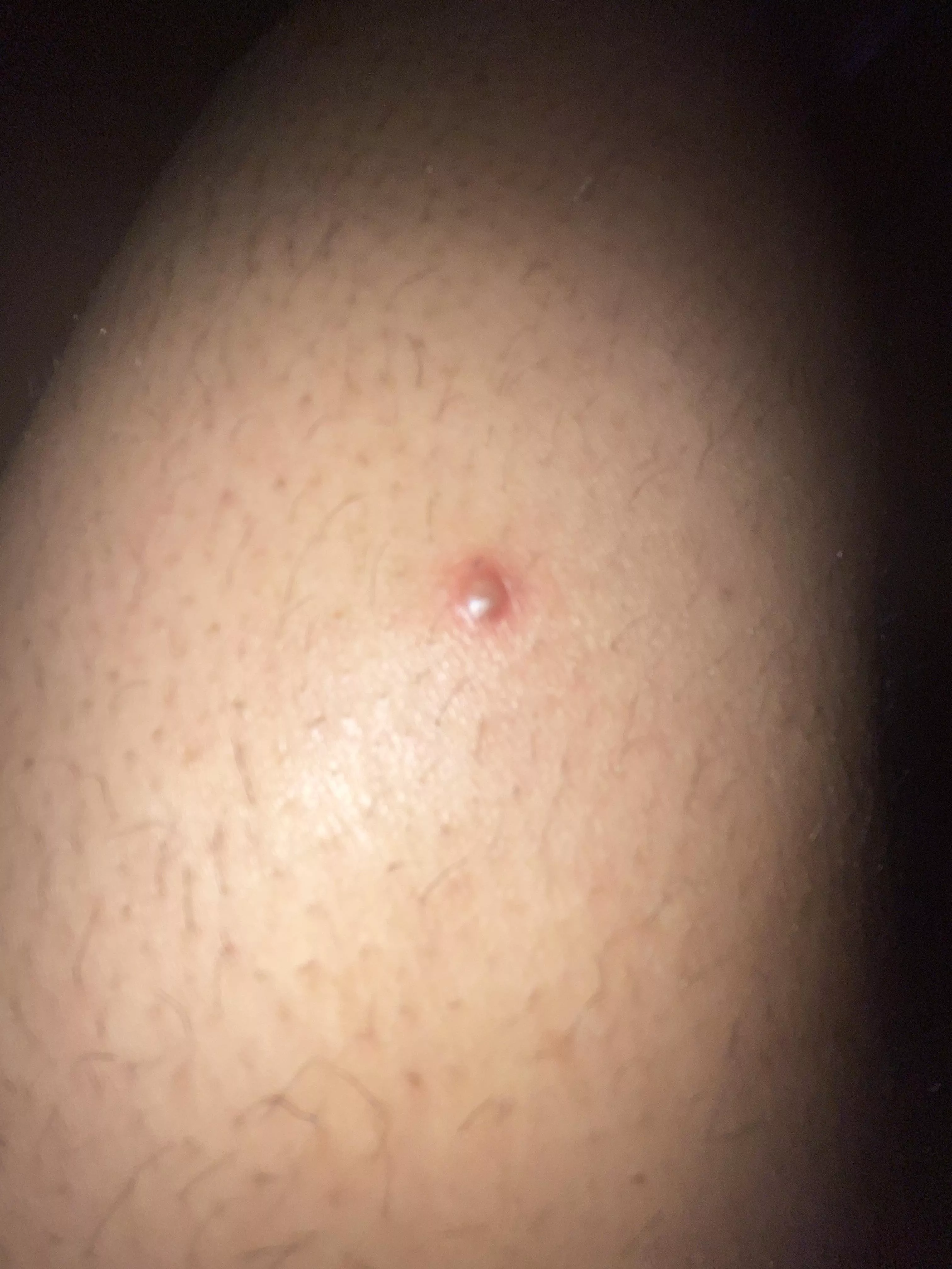 This randomly appeared on my thigh..anyone know what it is?? It hurts to touch