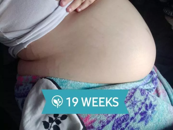 today is my 19 weeks in pregnancy