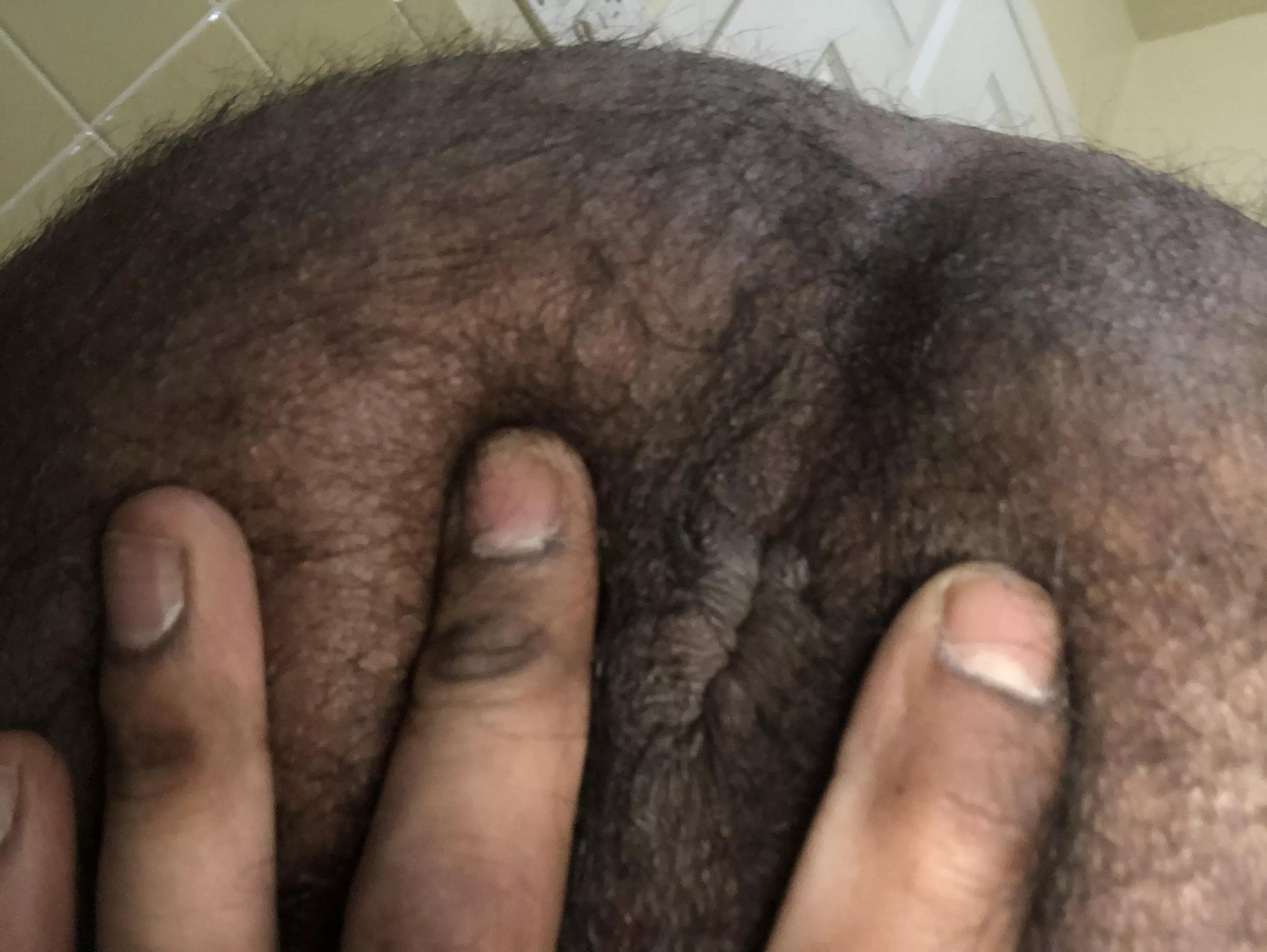 Too hairy for any love? 🍩