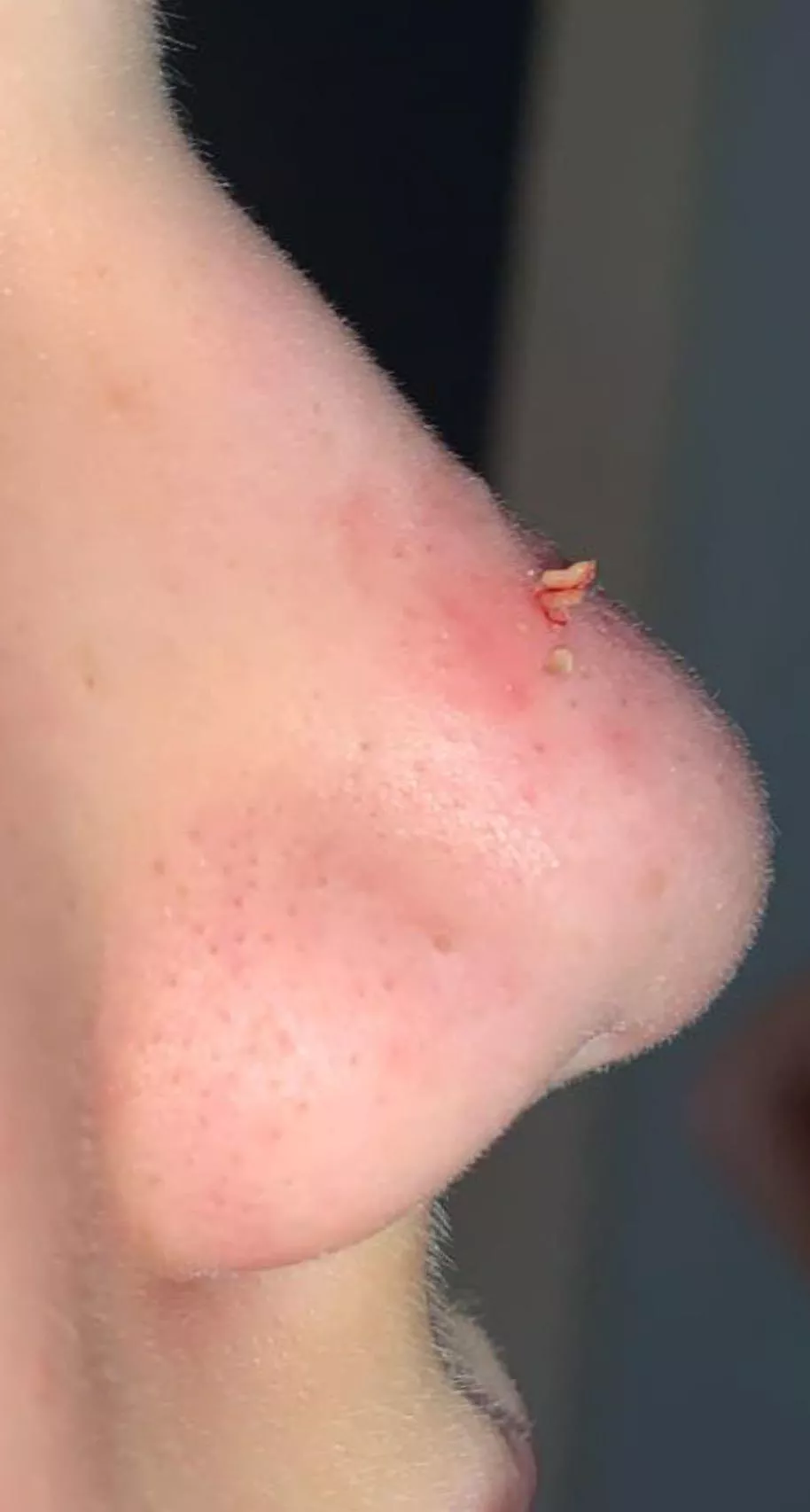 Tried to get a monster off of my 11 year olds nose, got 2.5.