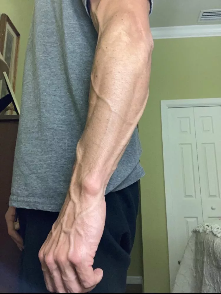 Veins like mountains