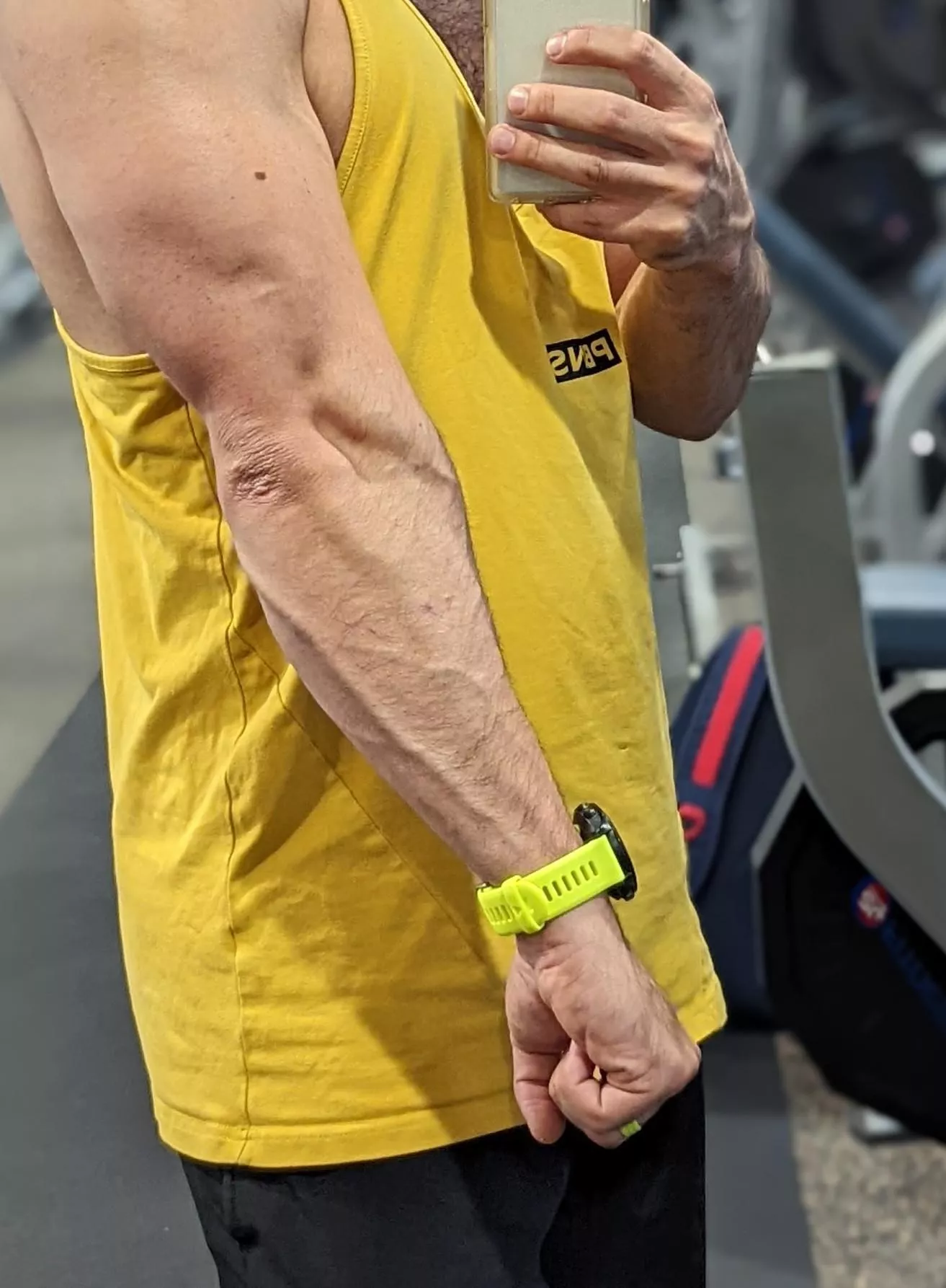 What do you all think about under-forearm veins?