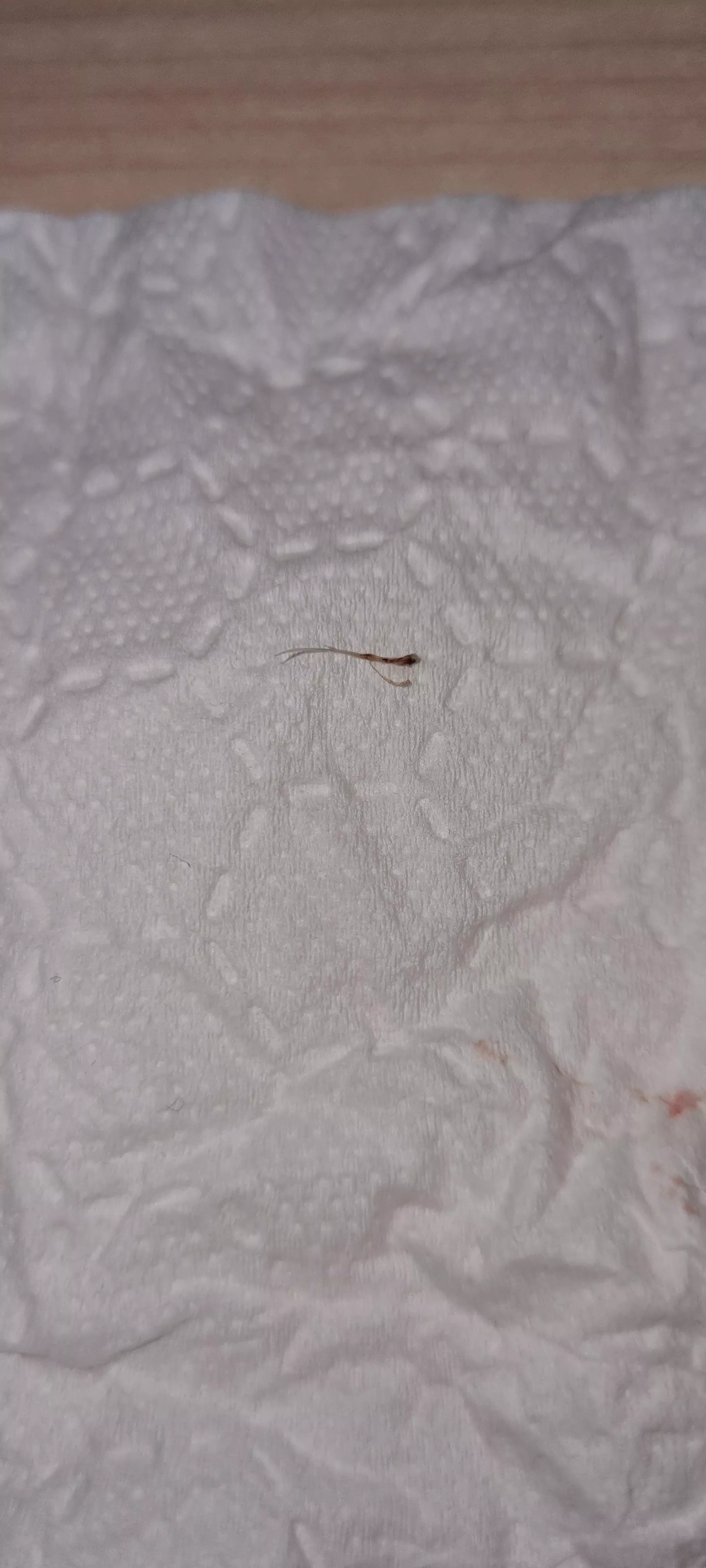 What do you call this? It just came out of the back of my head and now it won't stop bleeding.