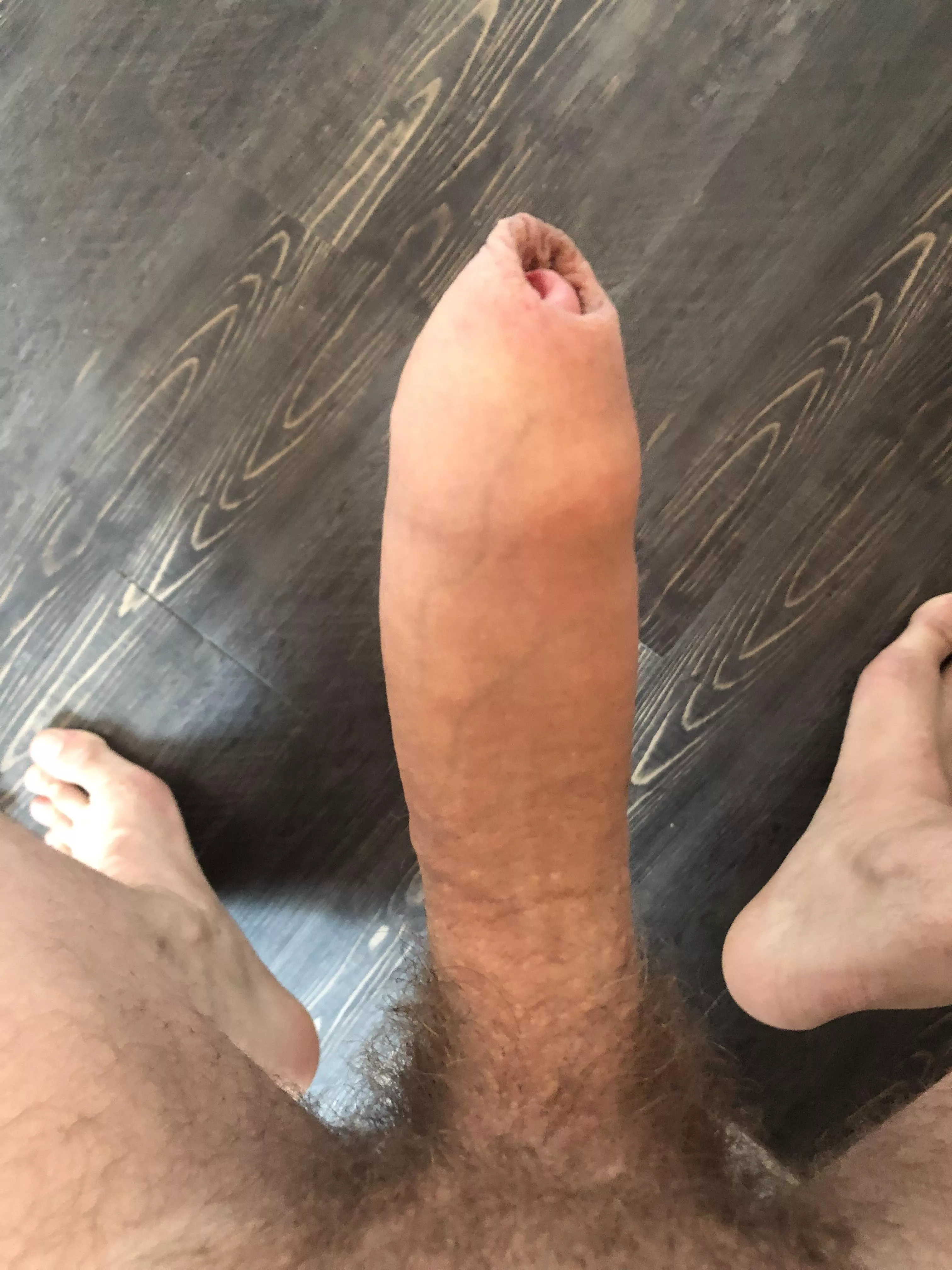 What do you think of my cock and foreskin?