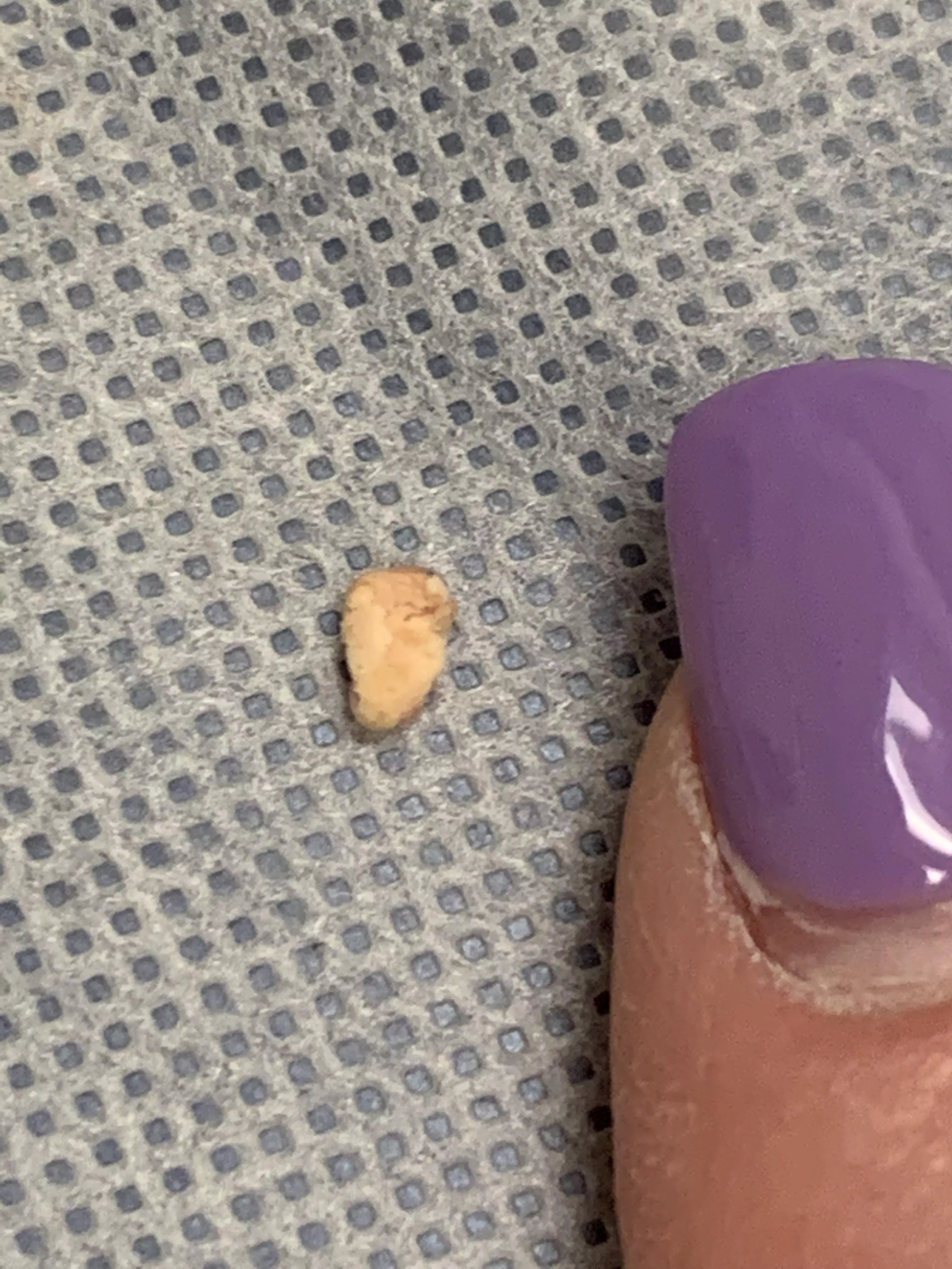 Whatever this is that blocked my Bartholin’s abscess from draining. No video. I was trying not to vomit because of the pain.