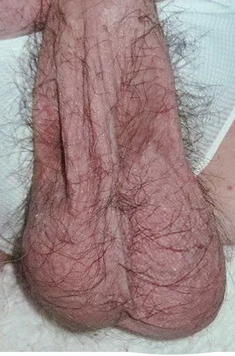 Who likes hairy balls?