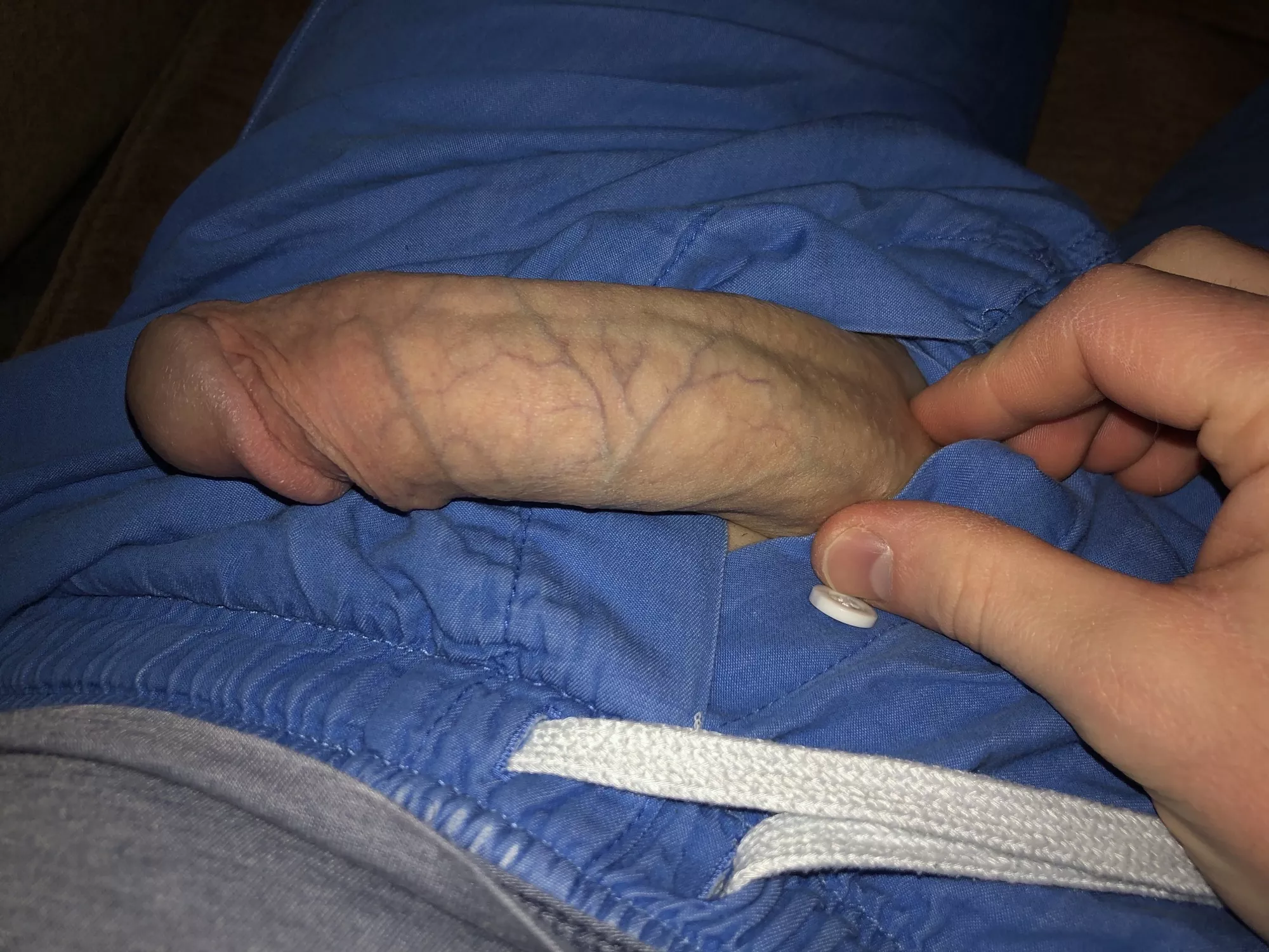 Who likes veins?