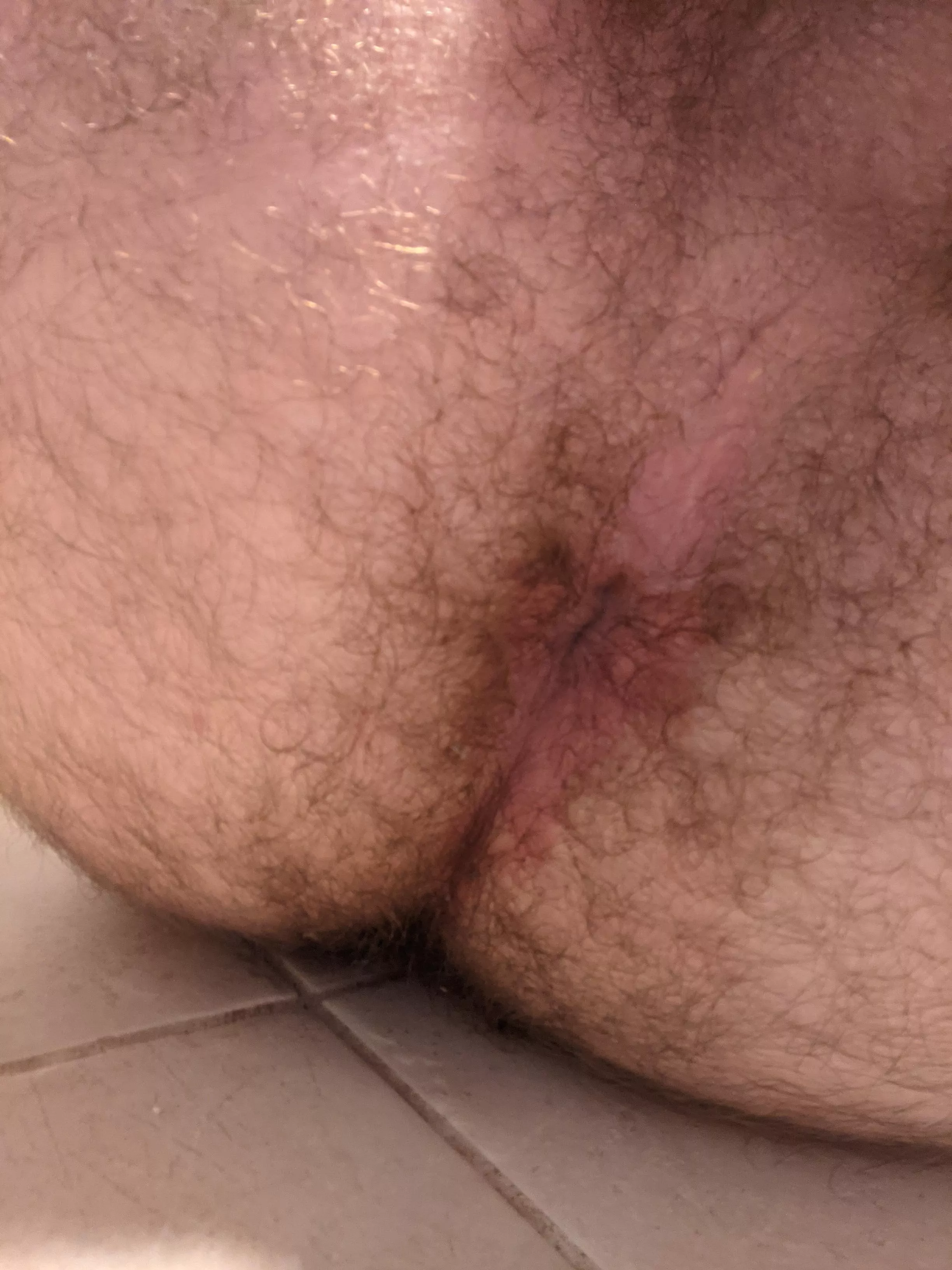 Would anyone like to fill my hole