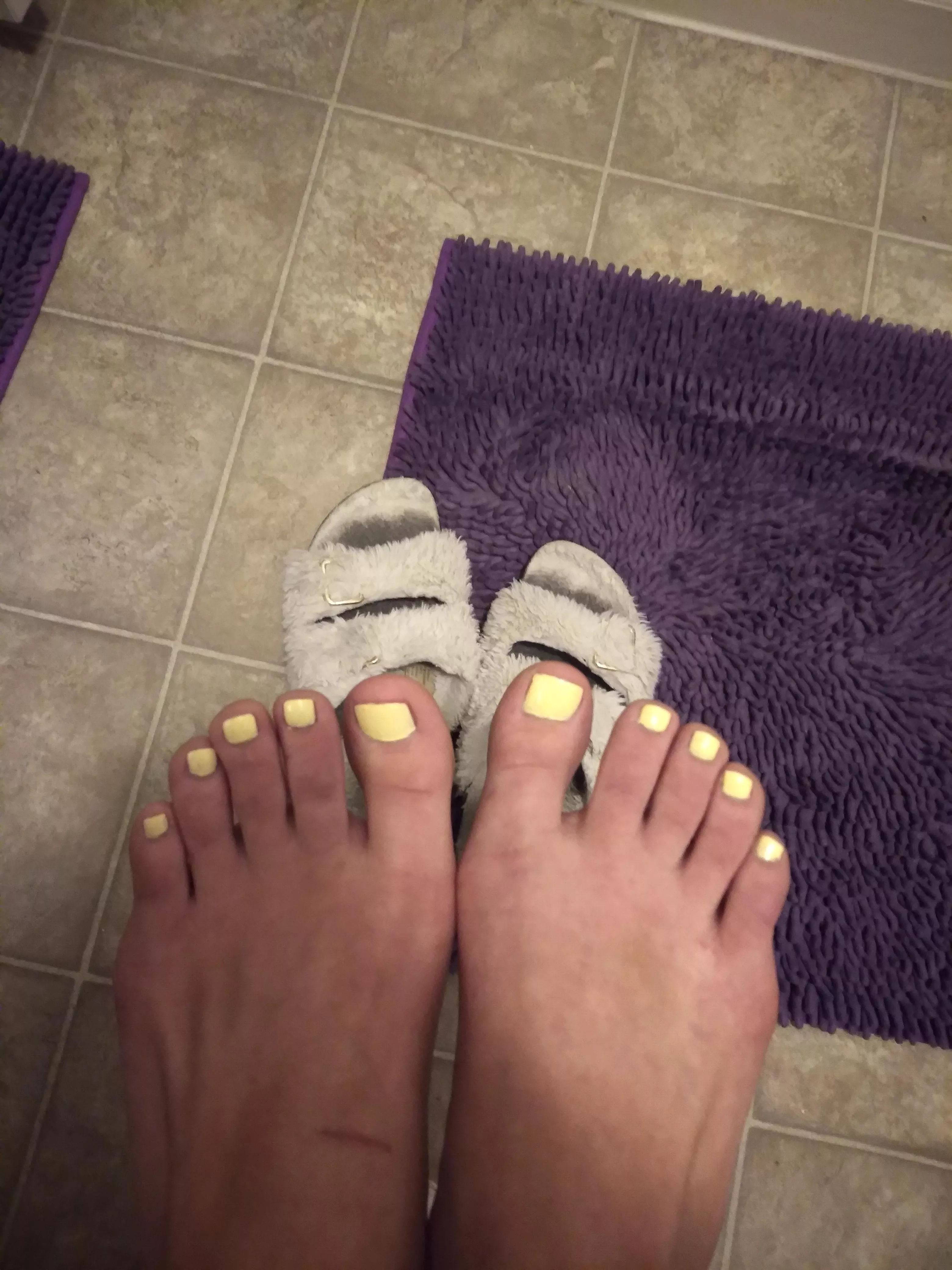 Yellow toes