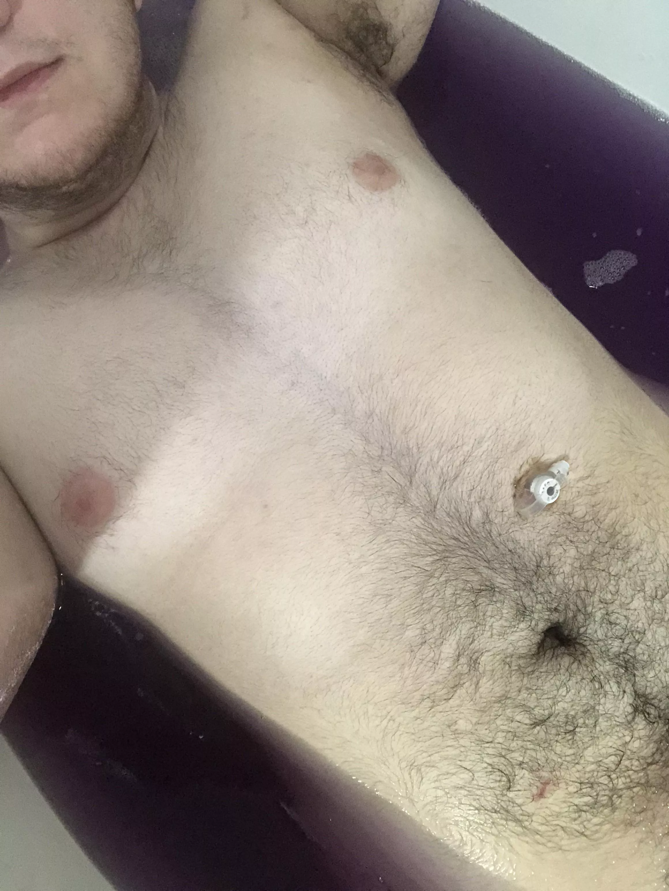 18FTM 5â€™9â€ 163lbs. First time posting, just enjoying the bath and this photo almost makes it look like ive had top surgery!