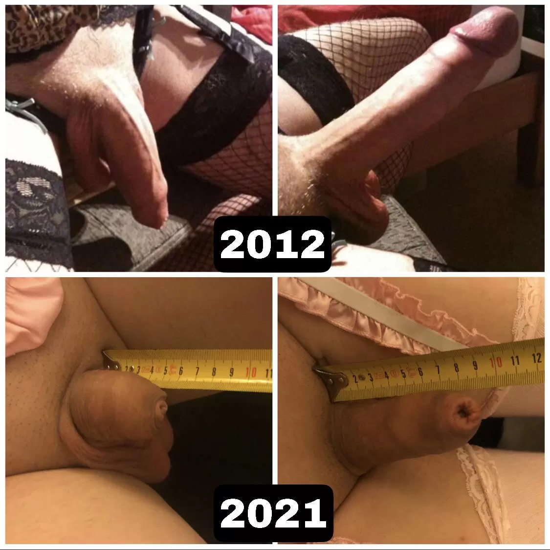 20cm (8 inches) to 9cm (3.5 inches) in 9 years. The result of long term chastity and a sexless relationship.