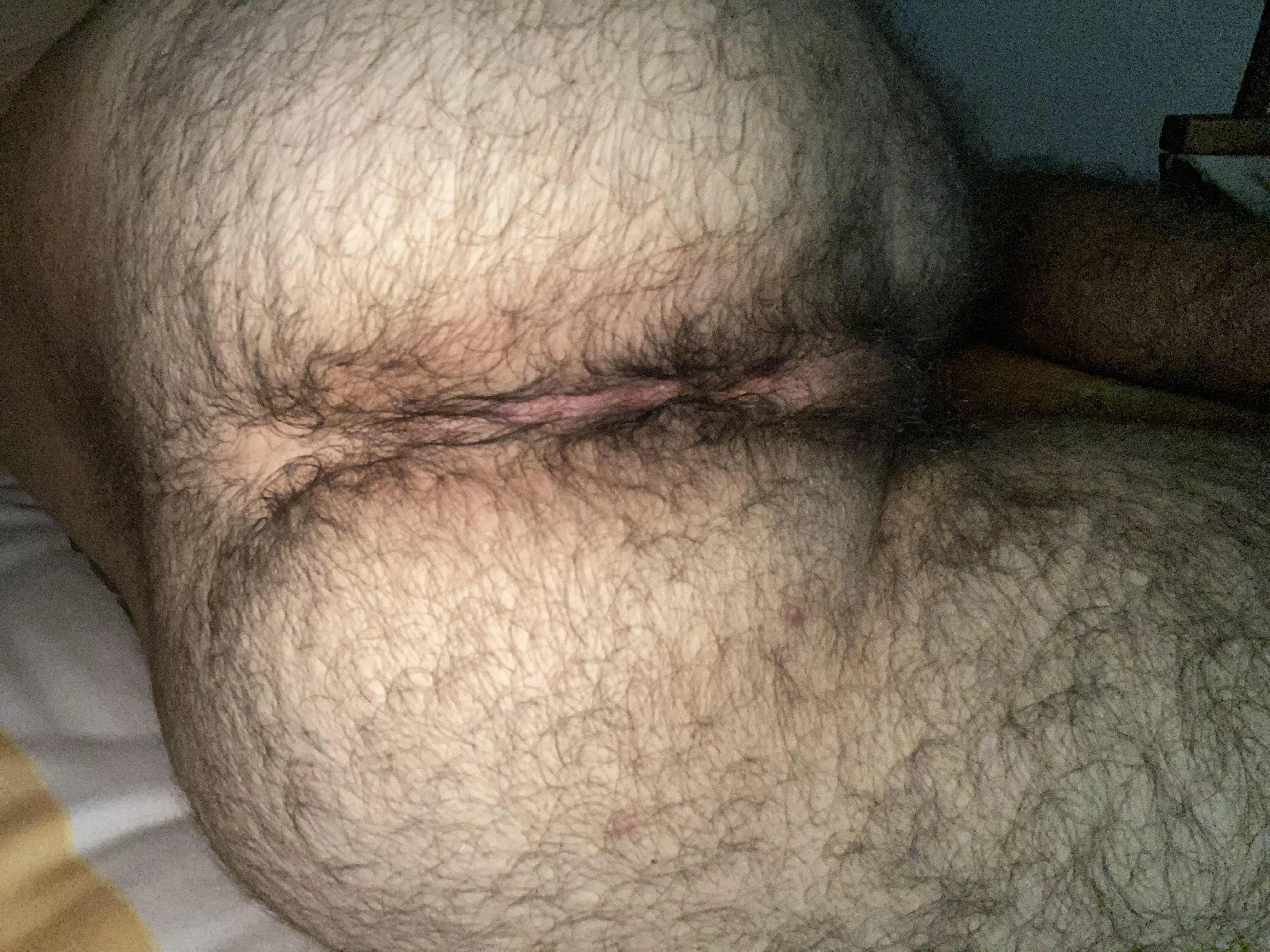 [24] Hairy enough?