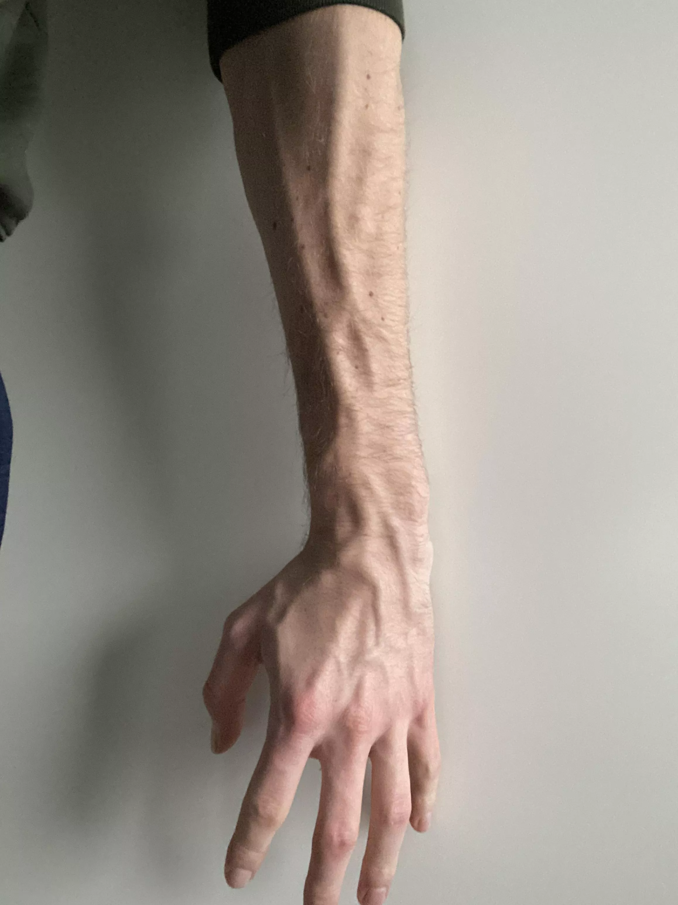 A bit of forearm and hand