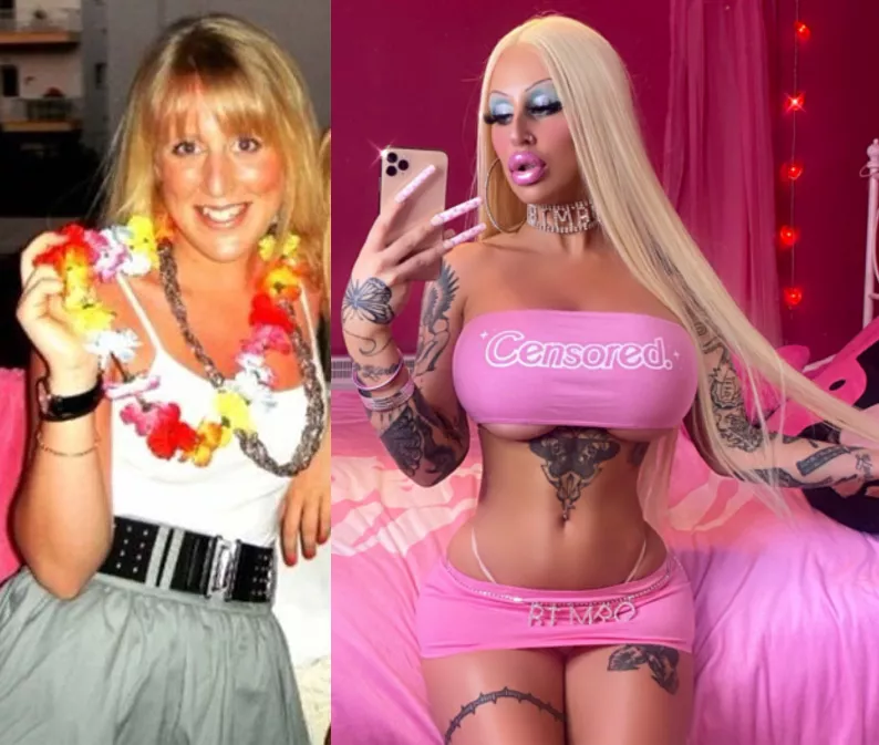 Alicia Amira Before And After