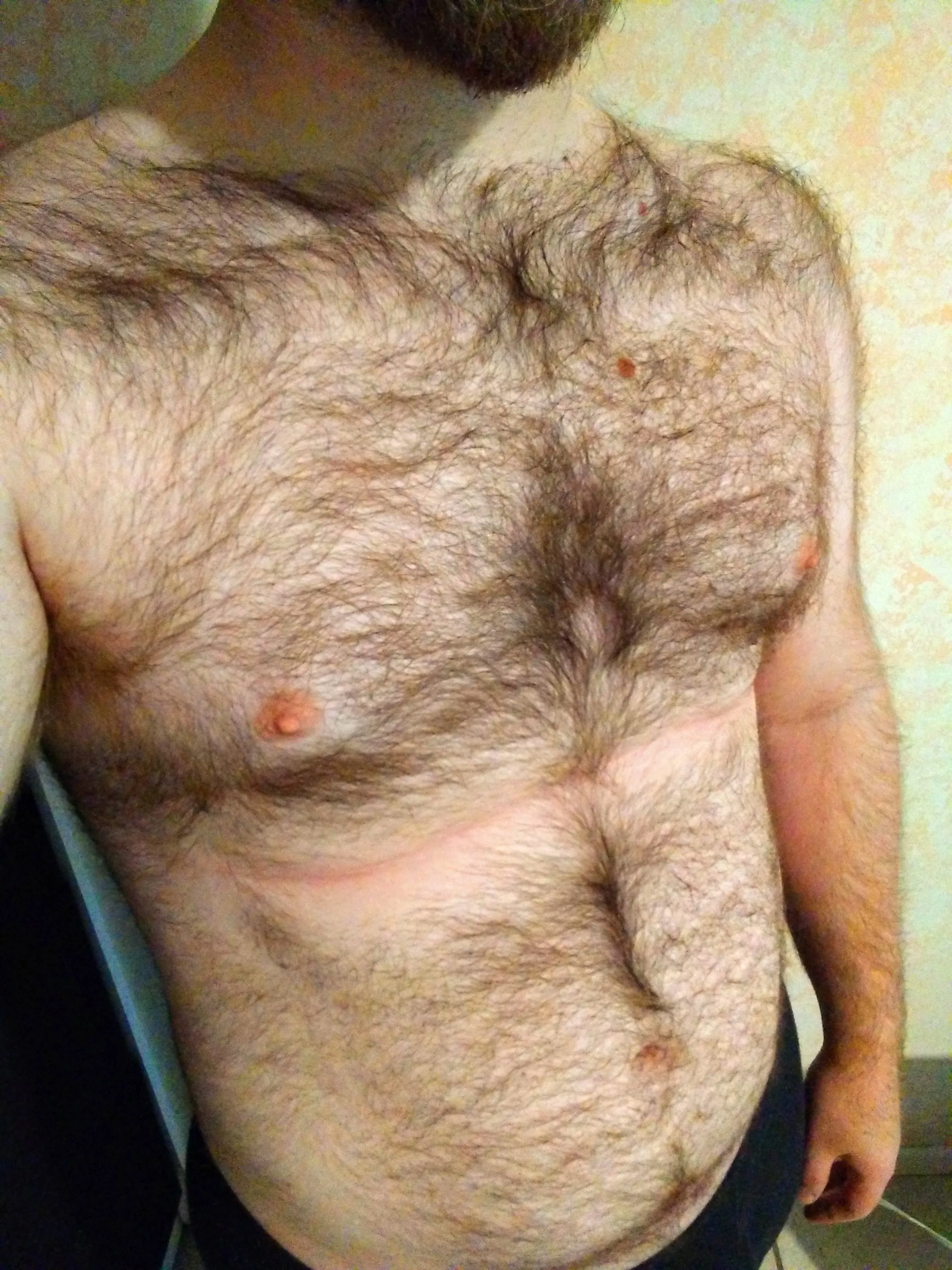 Am I too hairy?