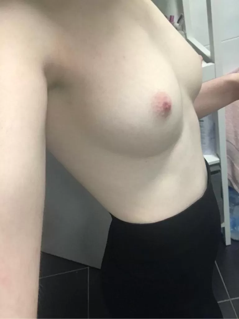 Any pale itty-bitty-titty love here??? 🥰 (F)