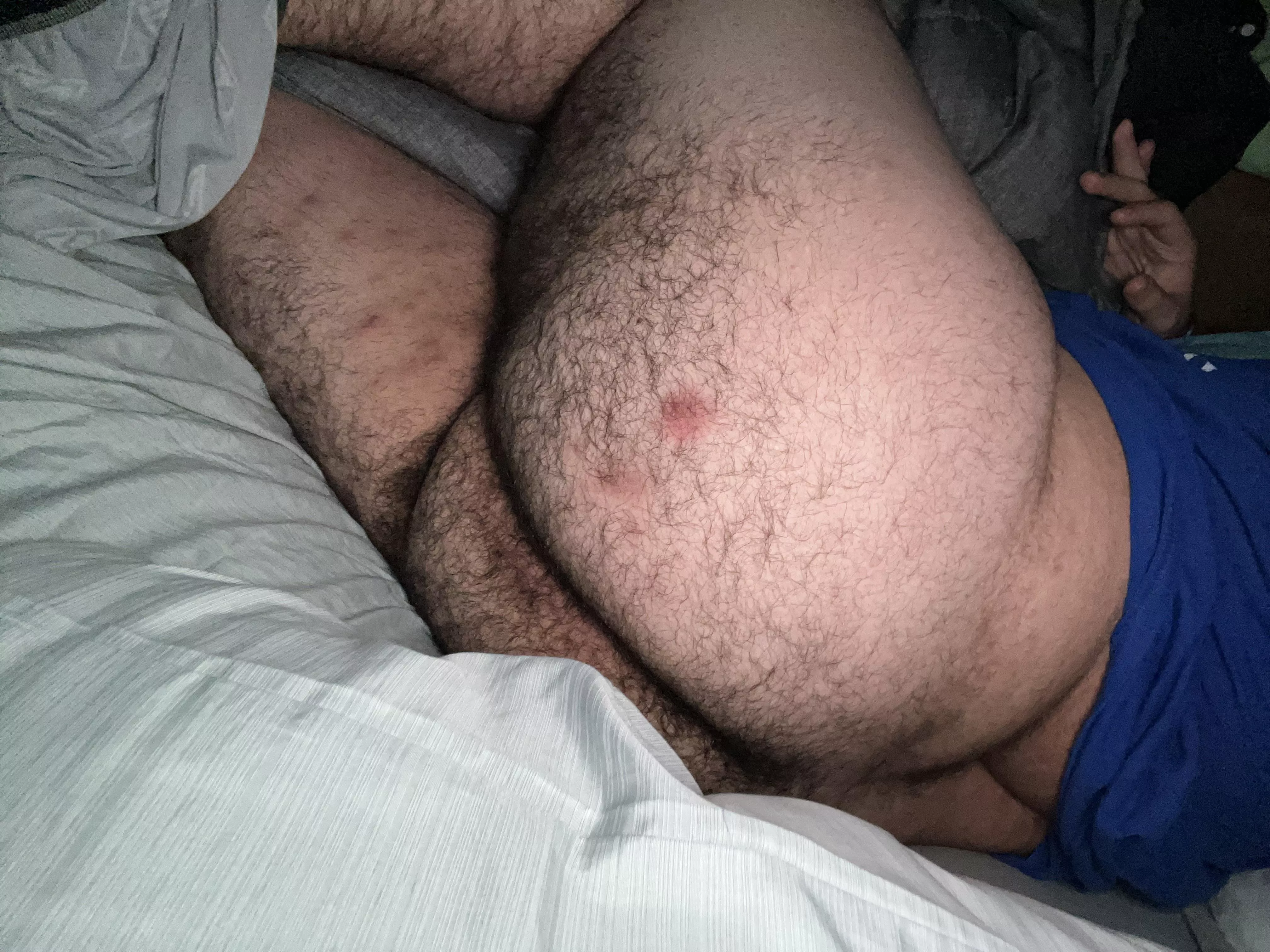 Anyone want to come rub my ass?