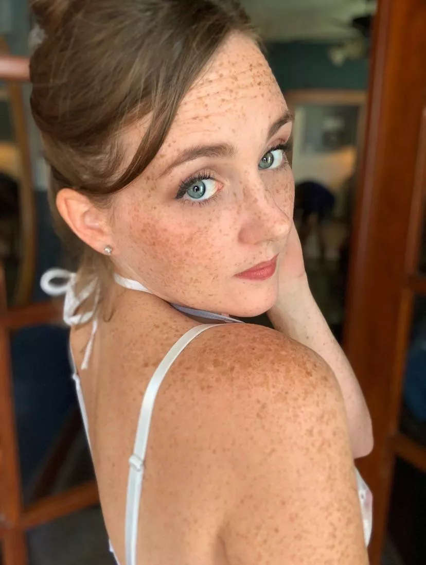 Back freckles ðŸ˜