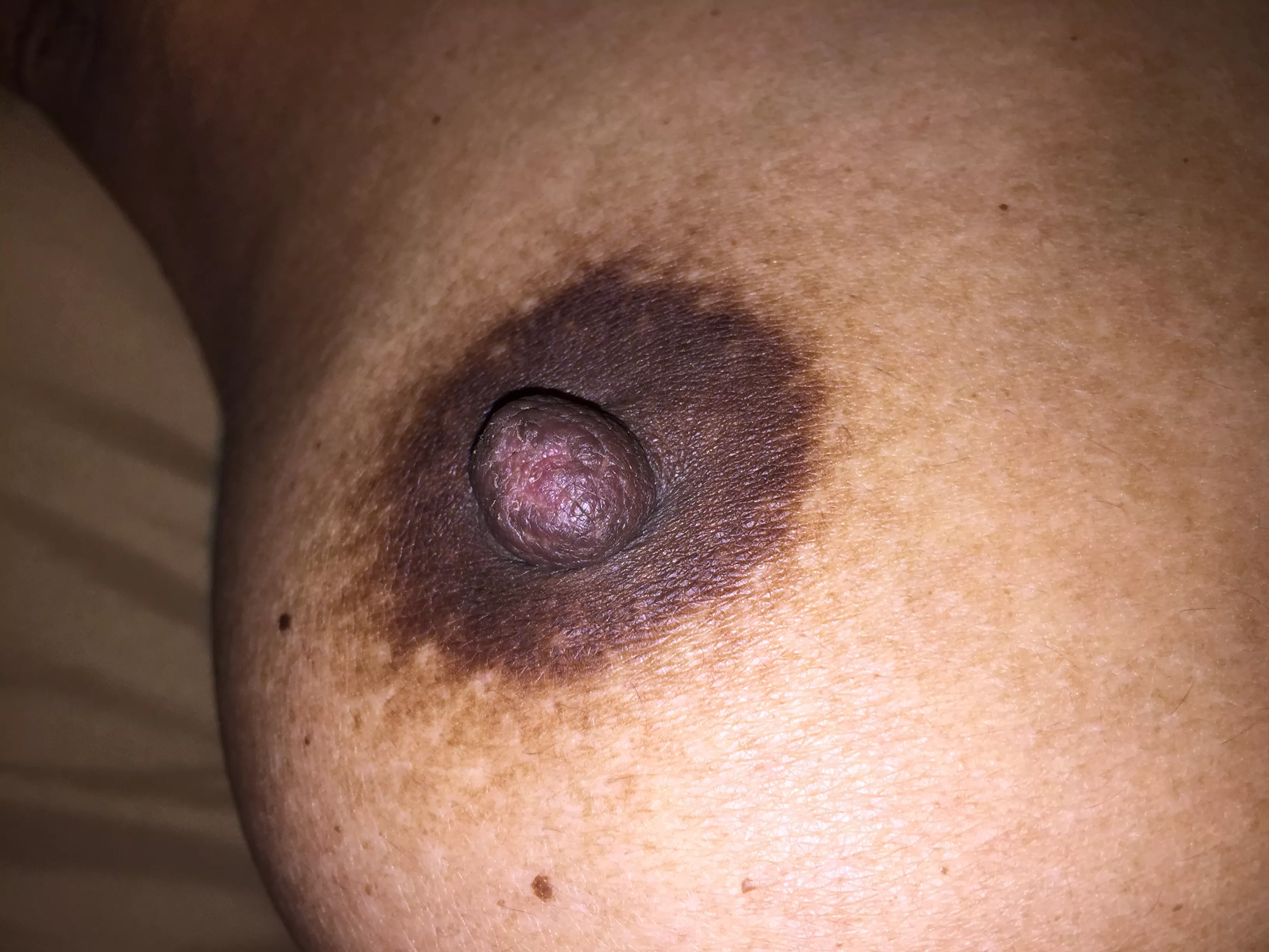 big asian nipple [F]