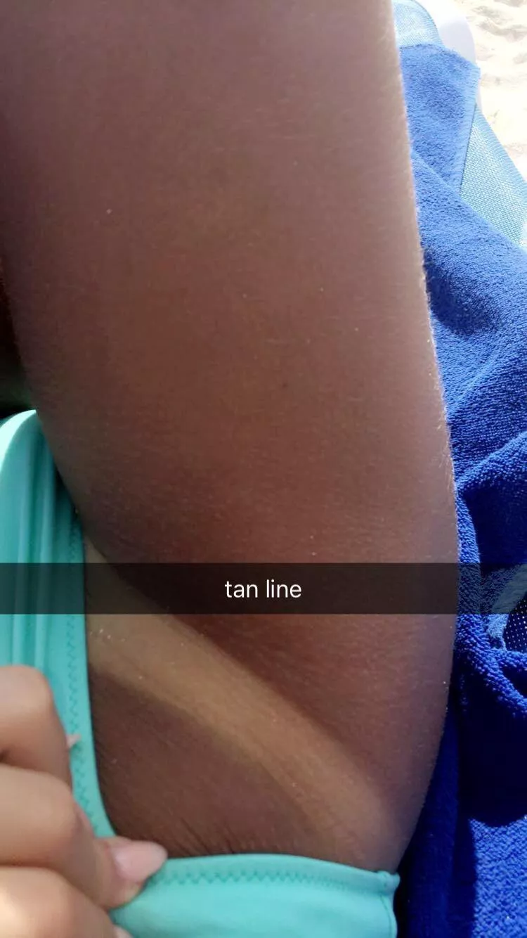 Bikini tan line