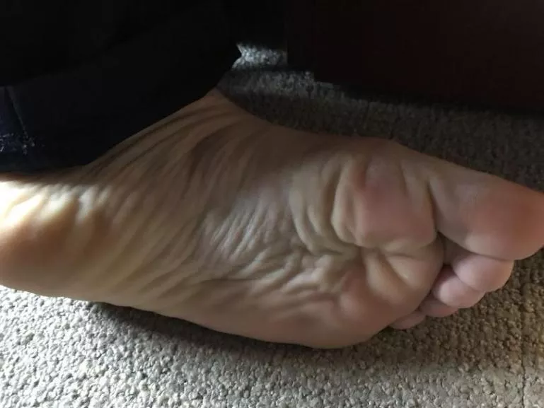 Can you count the wrinkles?