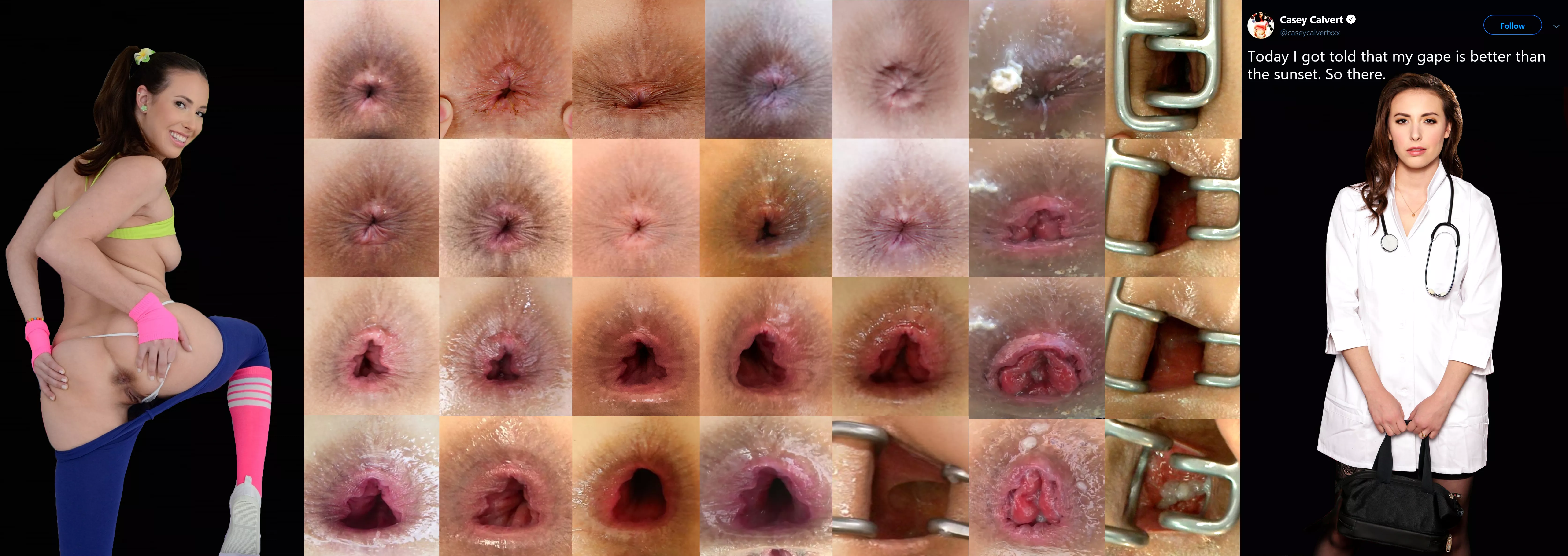 Casey Calvert's Asshole Collage