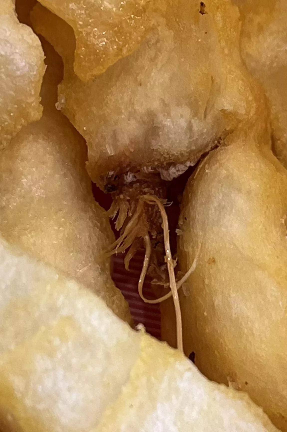 Clump of ingrown hairs (sorry about my dry skin)